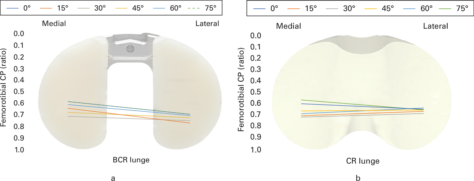 Fig. 5 
            a) Femorotibial contact points (CPs) projected on tibial insert during lunge task for bicruciate-retaining (BCR) total knee arthroplasty (TKA), displayed as a ratio from 0 (anterior) to 1 (posterior). The 0° line for the BCR group is overprojected by the 75° line. b) Femorotibial contact points projected on tibial insert during lunge task for cruciate-retaining (CR) TKA, displayed as a ratio from 0 (anterior) to 1 (posterior).
          