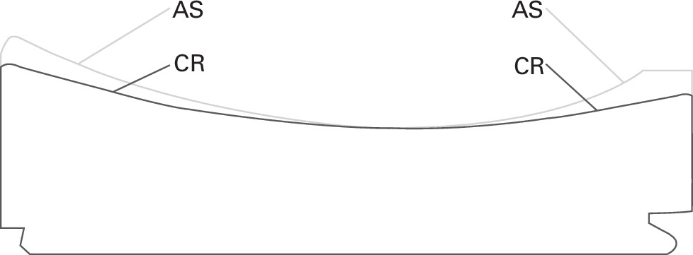 Fig. 2 
            Schematic drawing of the anterior-stabilized (AS) and cruciate-retaining (CR) inserts.
          