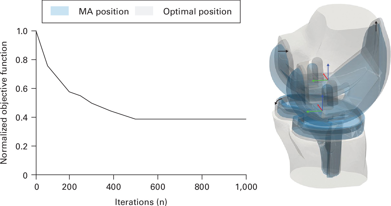 Fig. 2 
          a) The progression of the normalized objective function value over the number of iterations for a single, representative patient case, starting from the mechanical alignment (MA) position (value 1) and reaching the optimal implant position (approximate value 0.4), which corresponds to a 61.3% reduction. b) Illustration of the optimally positioned implant in situ relative to MA position for this particular case. Black arrows complement this visualization, highlighting certain positional adaptations of the components. The displayed coordinate systems represent the origin and orientation of the optimized femoral and tibial component position, respectively.
        