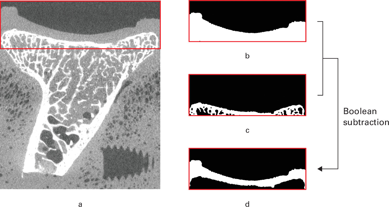 Fig. 3 
            a) A micro-CT slice of the glenoid. b) A binary image of the whole specimen. c) A binary image of the bone. d) The articular cartilage layer derived from Boolean subtraction between the whole specimen and the bone.
          