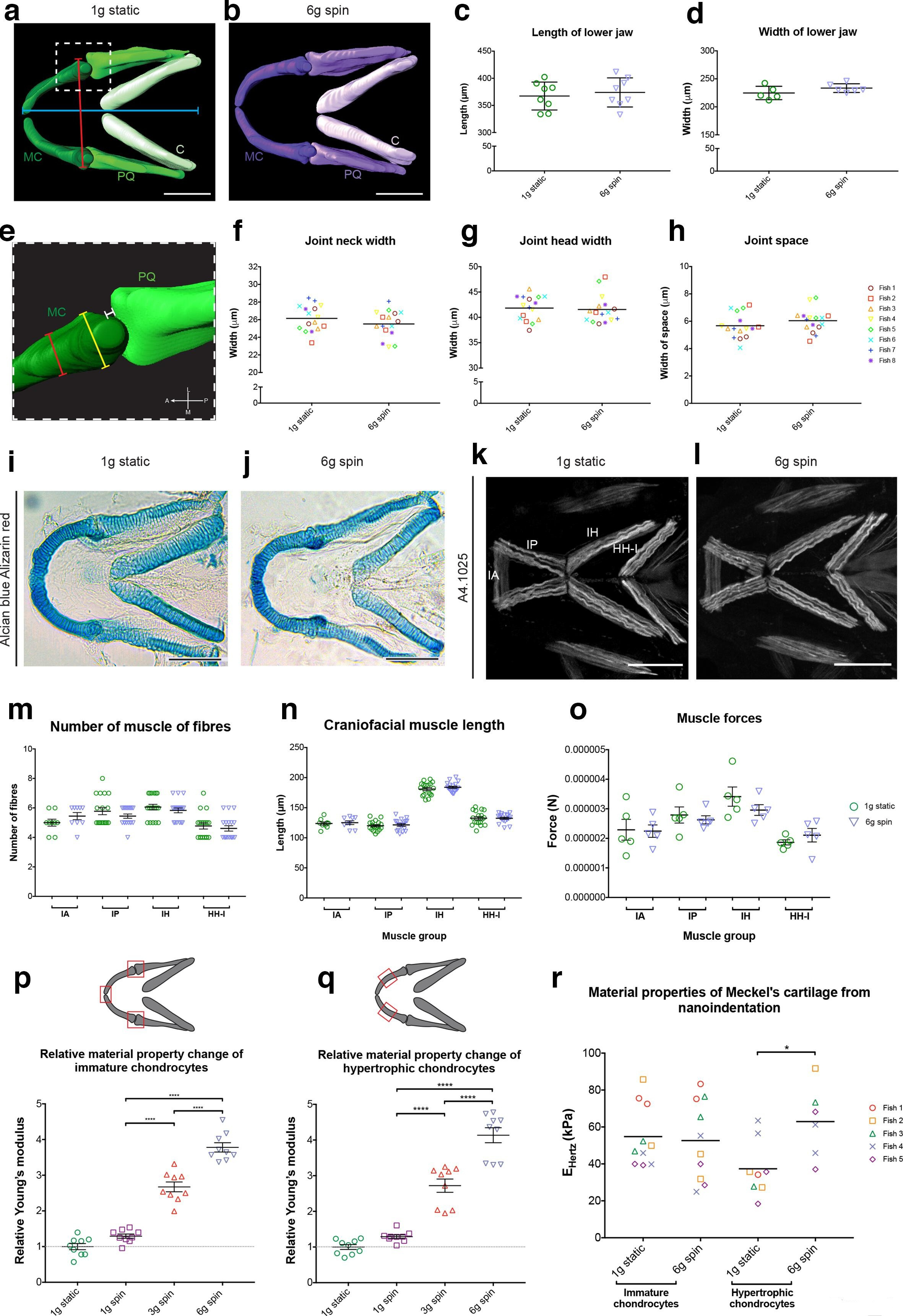 Fig. 1 
            Lower jaw morphology and musculature are unchanged following hypergravity exposure, but changes to cartilage material properties are observed. a) and b) 3D surface renders from confocal image stacks of lower jaw cartilage in ventral orientation from a) 1 g static and b) 6 g zebrafish at five days post-fertilization (dpf) (MC, Meckel’s cartilage; PQ, palatoquadrate; C, ceratohyal). Scale bar: 100 μm. c) and d) Quantification of c) lower jaw length and d) width. Location of measurements shown by red (width) and blue (length) line in Fig. 1a) (n = 8 for all, different symbols = individual fish). e) Close-up image of jaw joint from 1 g static 3D render, position of this region in the lower jaw is shown by white dashed box in Fig. 1a. Orientation compass: A, anterior; L, lateral; M, medial; P, posterior. f) to h) Quantification of f) joint neck and g) joint head width, and h) joint space; location of measurements shown in Fig. 1e. Red line = joint neck; yellow line = joint head; white line = joint space (n = 8 for all). i) and j) Brightfield images of Alcian blue Alizarin red-stained lower jaws from i) 1 g static and j) 6 g conditions. Scale bar = 100 μm. k) and l) Maximum projections of ventral confocal image stacks from 5 dpf j) 1 g static and k) 6 g zebrafish immunostained for myosin (A4.1025) (IA, intermandibularis anterior; IP, intermandibularis posterior; IH, interhyoideus; HH-I, hyohyoideus inferior). Scale bar = 100 μm. m) and n) Quantification muscle fibre m) number and n) length measured from confocal image stacks. Location of muscle groups shown in Fig. 1k). o) Quantification of craniofacial muscle forces. p) and q) Relative Young’s modulus (YM) values from atomic force microscopy (AFM) for p) immature and q) hypertrophic chondrocytes from 1 g static and 1 g, 3 g, and 6 g spin zebrafish (n = 3 for all). Location of measurements taken shown in schematic above graphs. r) Material properties determined by nanoindentation in 1 g static and 6 g spin zebrafish. Data are means with standard errors of the mean (SEM). (f) to h) show mean with no SEM), D’Agostino and Pearson test performed for all data, followed by independent-samples t-test in c), d), f), g), and h). One-way analysis of variance (ANOVA) performed within muscle groups in m), n), and o), and also in p) and q). Mann–Whitney U test used in r). *p ≤ 0.05, **p ≤ 0.01, ***p ≤ 0.001, ****p ≤ 0.0001.
          