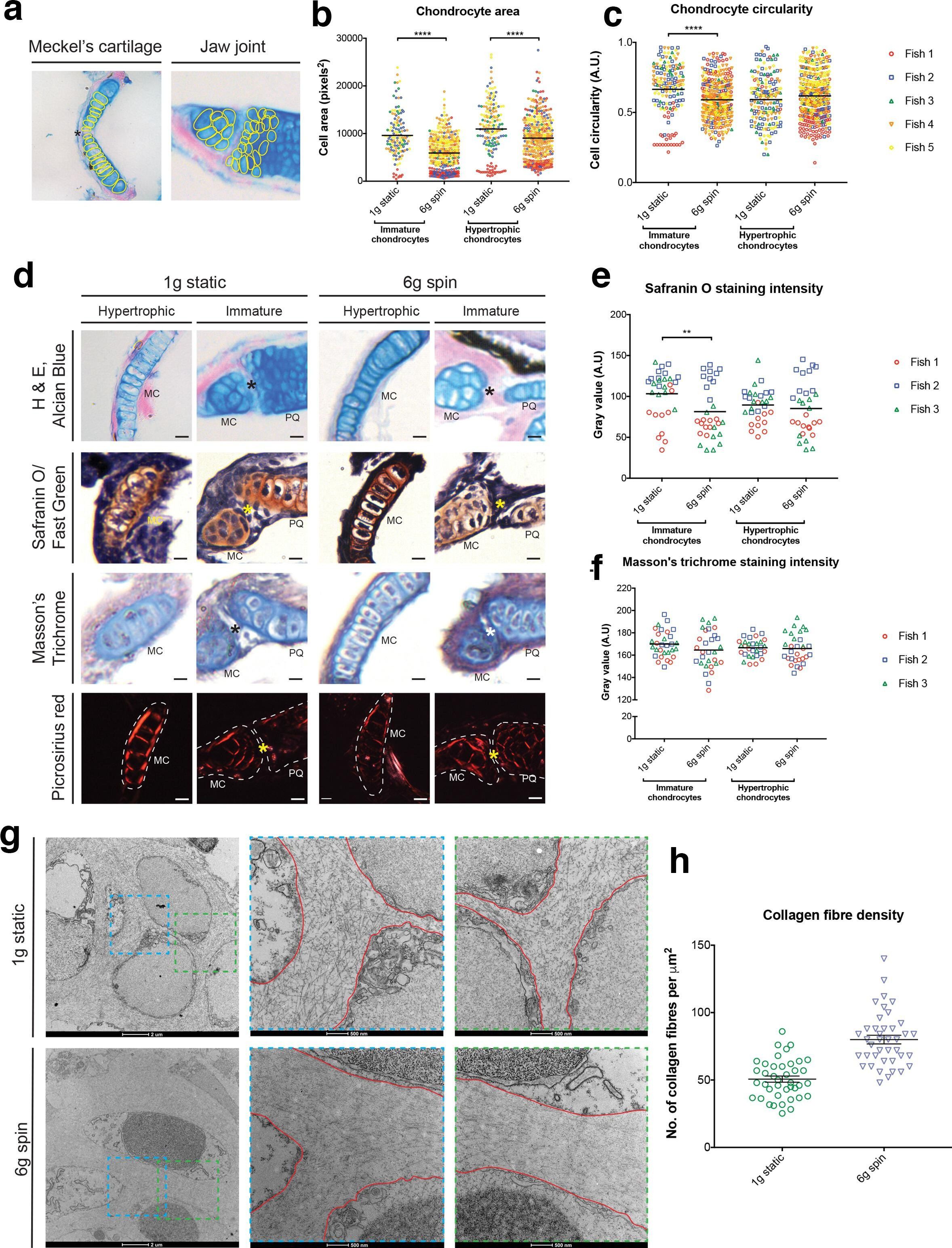 Fig. 2 
            Subtle changes to chondrocytes and their surrounding extracellular matrix (ECM) occur in areas of altered strain. a) Representative image with chondrocytes included in area and circularity measurements outlined in yellow. Black asterisk, Meckel’s symphysis. b) and c) Quantification of b) chondrocyte area and c) circularity (n = 5 for all, colours = individual fish). d) Alcian Blue, Haematoxylin and Eosin; Safranin O and Fast Green; Masson’s trichrome; and Picrosirius Red-stained ventral sections in 1 g static and 6 g spin fish. Asterisk = centre of joint; dotted line in Picrosirius Red images = outline of cartilage element from section. Scale bar = 10 μm. MC, Meckel’s cartilage; PQ, palatoquadrate. e) and f) Quantification of e) Safranin O and f) Masson’s trichrome staining intensity. g) Electron micrographs of hypertrophic chondrocytes in 1 g static and 6 g spin. Dashed areas = higher magnification images displayed in the centre and to the right of the panel; red lines = chondrocyte borders. Scale bars are shown below each image. h) Quantification of collagen fibre density in the ECM of 1 g static and 6 g spin fish (n = 1 for both, each point represents the number of fibres in 1 μm²). All data are means with standard errors of the mean (SEM). D’Agostino and Pearson normality test performed in b), c), e), and f): followed by Mann–Whitney U test in b) and c), and independent-samples t-test in e) and f). *p ≤ 0.05, **p ≤ 0.01, ***p ≤ 0.001, ****p ≤ 0.0001.
          