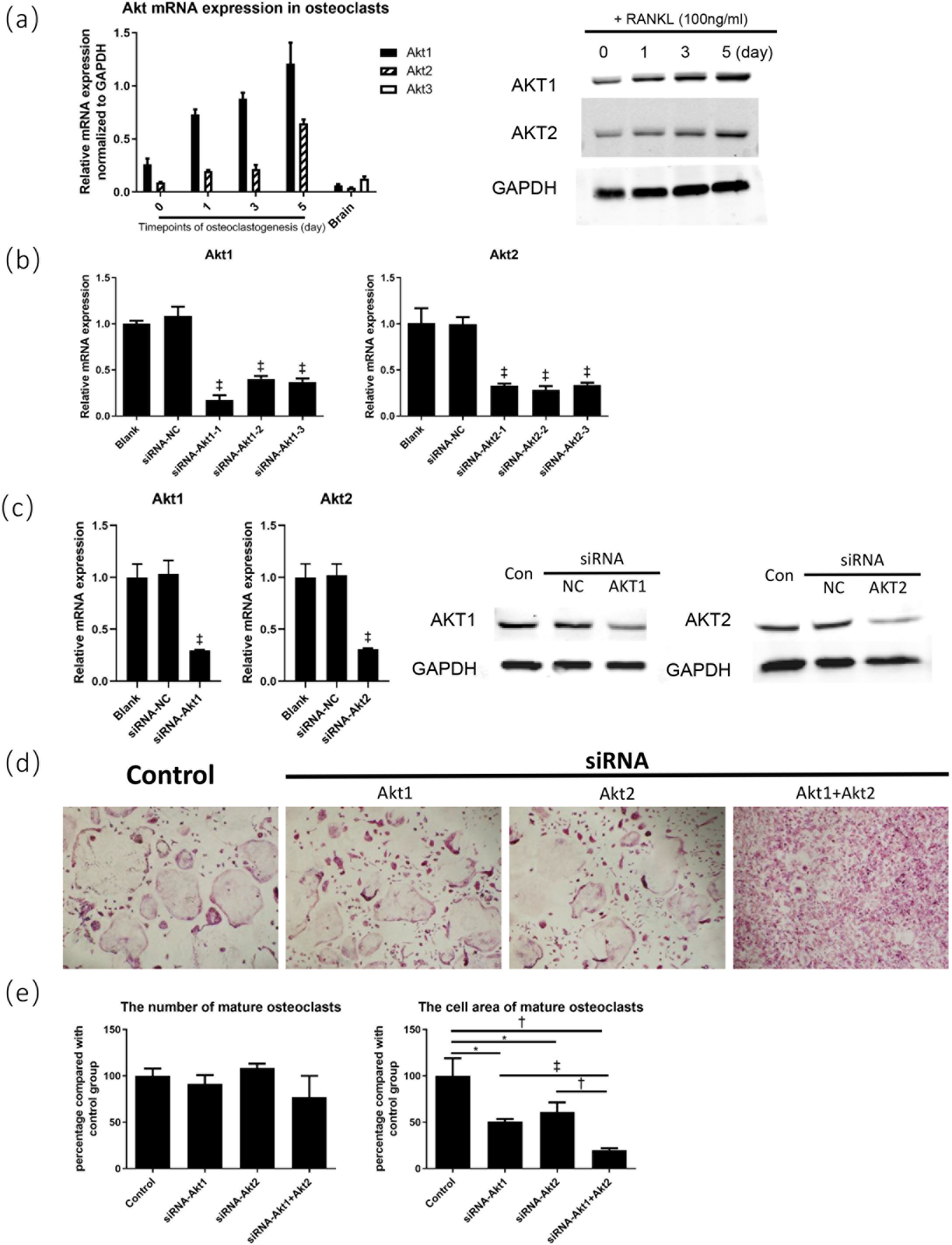 Fig. 4 
            Silencing of protein kinase B (Akt) inhibited osteoclast differentiation. a) Relative messenger RNA (mRNA) and protein expression levels of Akt isoforms during osteoclastogenesis. b) The performance verification of small interfering RNA (siRNA). Three different siRNA sequences of Akt1 were used, labelled siRNA-Akt1-1, siRNA-Akt1-2, and siRNA-Akt1-3, respectively, and the same labelling method was used for siRNA sequences of Akt2. All three siRNA sequences demonstrated similar effectiveness in suppressing mRNA expression, so they were mixed equivalently in the subsequent study (siRNA-Akt1 represented the mixture of Akt1-1, -2, and -3, same for siRNA-Akt2). c) The performance verification of pooled siRNA. d) The tartrate-resistant acid phosphatase (TRAP) staining (100×) of mature osteoclasts after Akt silencing and receptor activator of nuclear factor κB ligand (RANKL) stimulation. e) The measurement and analysis of mature osteoclasts after Akt silencing. *p < 0.05, †p < 0.01, ‡p < 0.001. Akt1, AKT serine/threonine kinase 1; Akt2, AKT serine/threonine kinase 2; Akt3, AKT serine/threonine kinase 3; Con, control group; GAPDH, glyceraldehyde-3-phosphate dehydrogenase; NC, negative control.
          