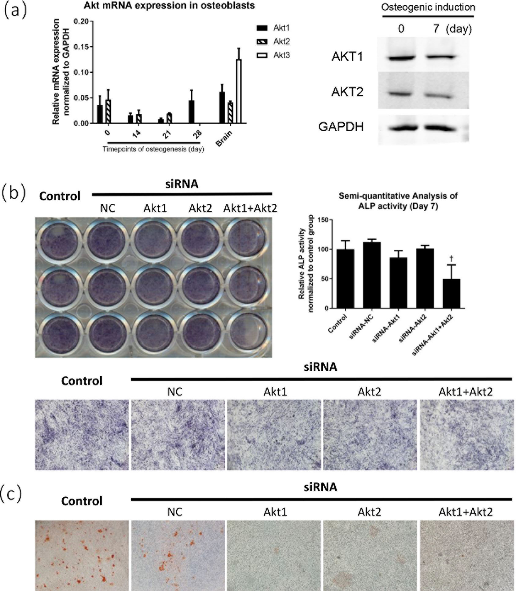 Fig. 7 
            Silencing of protein kinase B (Akt) inhibited osteoblast differentiation. a) Relative messenger RNA (mRNA) and protein expression levels of Akt isoforms in osteoblasts. b) Alkaline phosphatase (ALP) staining (100×) and semiquantitative analysis of MC3T3-E1 cell line after Akt silencing and osteogenic induction for seven days. c) Alizarin Red (AR) staining (100×) of MC3T3-E1 cell line after Akt silencing and osteogenic induction for 21 days. *p < 0.05, †p < 0.01, ‡p < 0.001. siRNA, small interfering RNA. NC, negative control; Akt1, AKT serine/threonine kinase 1; Akt2, AKT serine/threonine kinase 2; Akt3, AKT serine/threonine kinase 3; GAPDH, glyceraldehyde-3-phosphate dehydrogenase; NC, negative control.
          