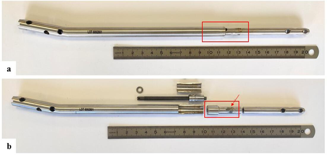 Fig. 5 
            a) Explanted Stryde nail (patient no. 3). The red box indicates the area affected by corrosive changes at the telescopic junction. b) Disassembled Stryde nail with cut sections at the telescopic junction. The red box indicates the region of interest for further microscopical analysis. The red arrow points at the corrosive material loss, which is shown in Figures 6 to 8 in higher magnification (b). Images taken with a Sony α58 camera (Sony AG, Japan).
          