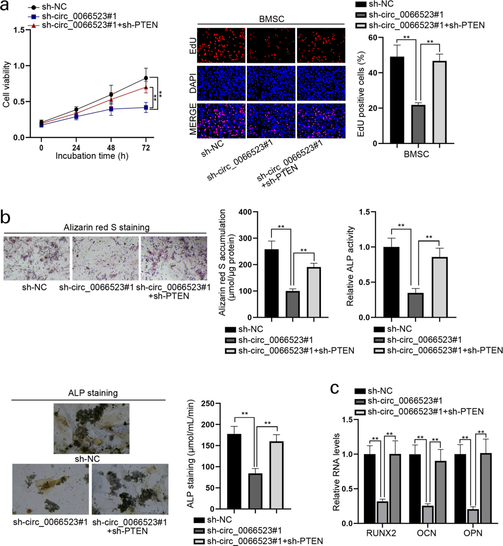 Fig. 5 
            Phosphatase and tensin homolog (PTEN) knockdown counteracts the effects of circ_0066523 interference on the behaviours of bone mesenchymal stem cells (BMSCs). a) The proliferation of indicated BMSCs was evaluated by Cell Counting Kit 8 (CCK8) and 5-ethynyl-2’-deoxyuridine (EdU) assays (magnification 100×). b) Alizarin Red S staining, alkaline phosphatase (ALP) activity assay, and ALP staining analyzed the osteoblastic phenotypes of transfected BMSCs (magnification 200×). c) The levels of runt-related transcription factor 2 (RUNX2), osteocalcin (OCN), and osteopontin (OPN) in indicated BMSCs were detected by quantitative real-time polymerase chain reaction (qRT-PCR). **p < 0.01. DAPI, 4′,6-diamidino-2-phenylindole; sh-NC, negative control short hairpin RNA.
          