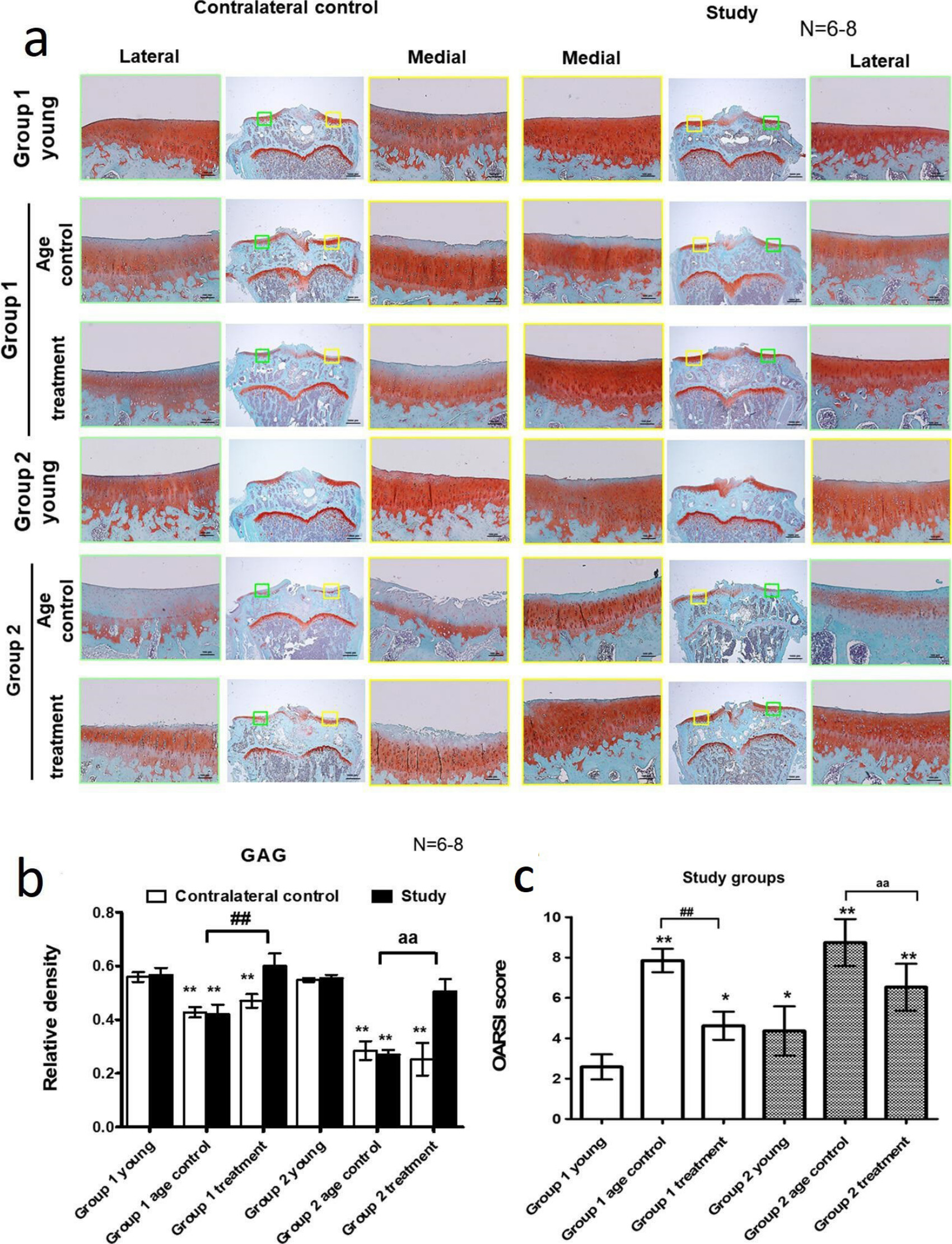 Fig. 2 
            Effect of parathryroid hormone (PTH) (1-34) on histological appearance and glycosaminoglycan (GAG) level in articular cartilage. a) Representative micrographs of the Safranin-O-stained articular cartilages. At the age of six months (Group 1), guinea pigs were assigned into a control (Group 1 control; n = 7) or osteoarthritis (OA) with PTH (1-34) treatment (Group 1 treatment) group (n = 8). Another eight three-month-old guinea pigs were purchased and served as the young control group (Group 1 young; n = 8). Guinea pigs at seven months old (Group 2) were randomized into either the control (Group 2 control; n = 6) or OA with PTH (1-34) treatment (Group 2 treatment) group (n = 6). Another eight four-month-old guinea pigs were purchased and served as the young control group (Group 2 young; n = 8). All guinea pigs received treatment once per week for three months. Representative micrographs of the Safranin-O-stained articular cartilages of the proximal tibia from the study joints in all groups are shown (×1.25 and ×10). b) The relative density of Safranin-O-stained area. The ratio of Safranin-O-stained area to total area (red/total) was measured and compared among groups. Each bar represents the mean and standard error of the mean (SEM) of samples in each group. **p < 0.01 versus Group 1 young group. ##p < 0.01 versus Group 1 age control group. aa: p < 0.01 versus Group 2 age control group. c) The Osteoarthritis Research Society International (OARSI) scores were measured and compared among groups. Each bar represents the mean and SEM of samples in each group. *p < 0.05 versus Group 1 young group. **p < 0.01 versus Group 1 young group. ##p < 0.01 versus Group 1 age control group. aa: p < 0.01 versus Group 2 age control group.
          