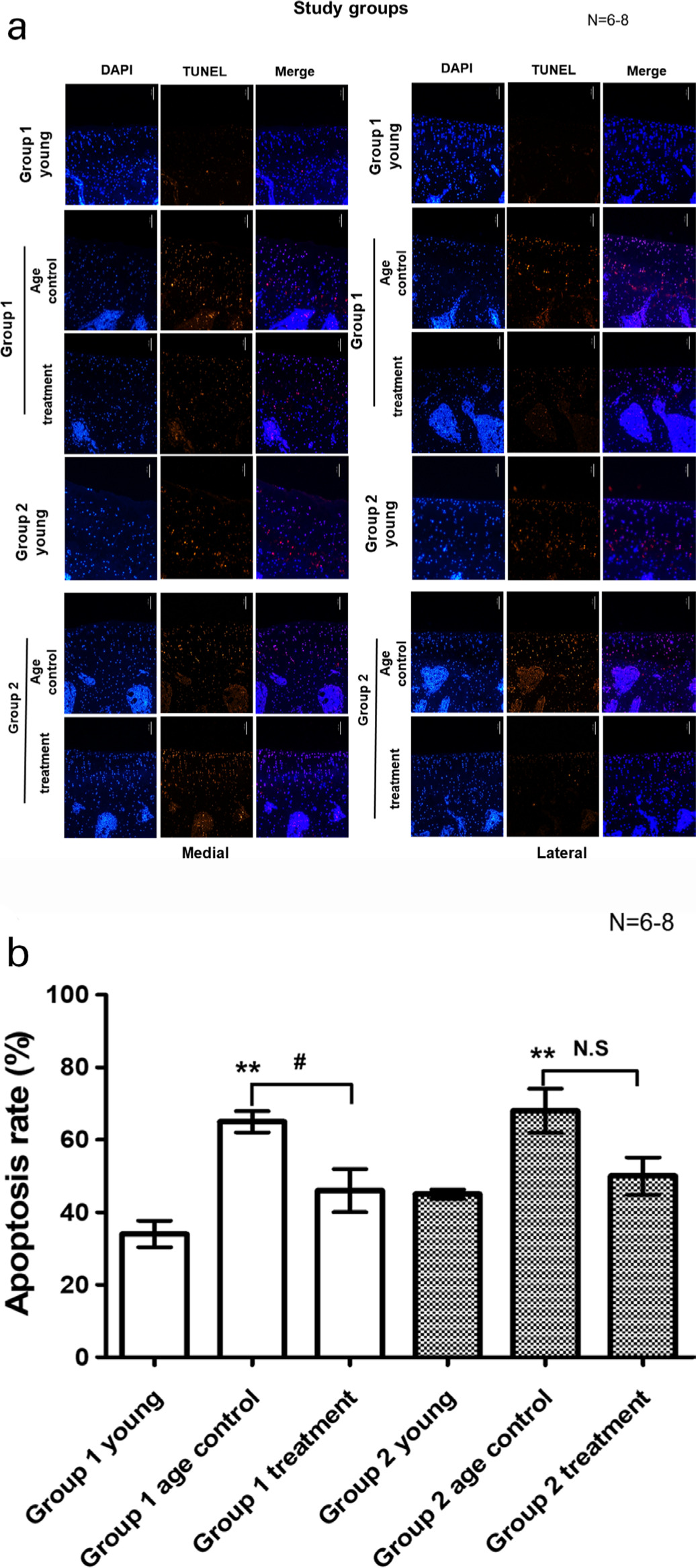 Fig. 3 
            Effect of parathryoid hormone (PTH) (1-34) on chondrocyte apoptosis in articular cartilage. At the age of six months (Group 1), guinea pigs were assigned into a control (Group 1 control; n = 7) or osteoarthritis (OA) with PTH (1-34) treatment (Group 1 treatment) group (n = 8). Another eight three-month-old guinea pigs were purchased and served as the young control group (Group 1 young; n = 8). Guinea pigs at seven months of age (Group 2) were randomized into either the control (Group 2 control; n = 6) or OA with PTH (1-34) treatment (Group 2 treatment) group (n = 6). Another eight four-month-old guinea pigs were purchased and served as the young control group (Group 2 young; n = 8). All guinea pigs received treatment once per week for three months. a) Representative micrographs (×10) of the 4′,6-diamidino-2-phenylindole (DAPI)- and terminal deoxynucleotidyl transferase dUTP nick end labeling (TUNEL)-stained articular cartilages of the proximal tibia from the study joints of all groups are shown. b) The quantifications of apoptotic rate are shown. Each bar represents the mean and standard error of the mean of samples in each group. **p < 0.01 versus Group 1 young group. #p < 0.05 versus Group 1 age control group. N.S., non-significant.
          