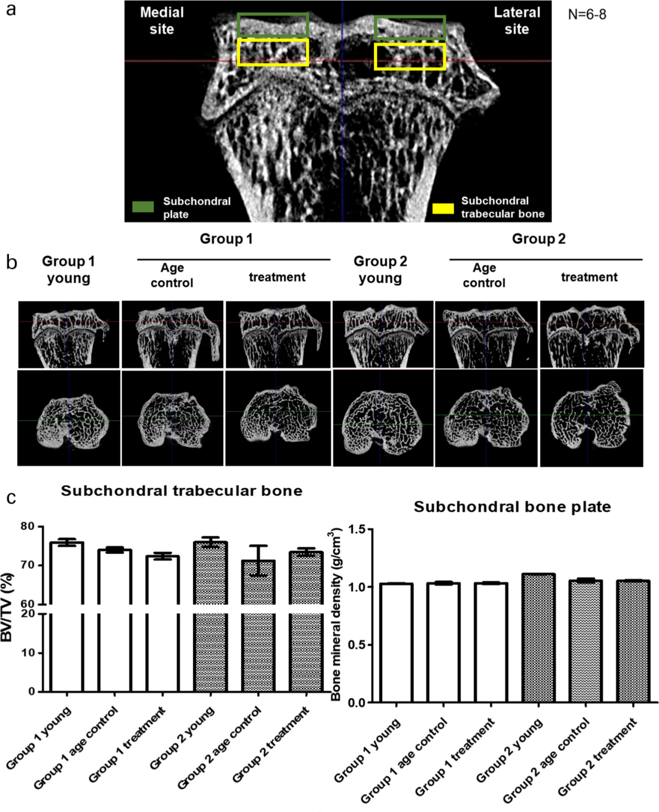 Fig. 4 
            Effect of parathryroid hormone (PTH) (1-34) on subchondral bone microarchitecture in microcalculated tomography (μCT). At the age of six months (Group 1), guinea pigs were assigned into a control (Group 1 control; n = 7) or osteoarthritis (OA) with PTH (1-34) treatment (Group 1 treatment) group (n = 8). Another eight three-month-old guinea pigs were purchased and served as the young control group (Group 1 young; n = 8). Guinea pigs at seven months old (Group 2) were randomized into either the control (Group 2 control; n = 6) or OA with PTH (1-34) treatment (Group 2 treatment) group (n = 6). Another eight four-month-old guinea pigs were purchased and served as the young control group (Group 2 young; n = 8). All guinea pigs received treatment once per week for three months. a) Definition of bone microarchitecture measurement. b) The 3D reconstruction showed the same subchondral bone plate and trabecular bone volume in all groups. c) The quantifications of subchondral trabecular bone volume are shown. There was no significant difference between groups. The quantifications of bone volume (BV)/total volume (TV) in subchondral trabecular bone and bone mineral density in subchondral bone plate volume are also shown, with no significant difference between groups.
          