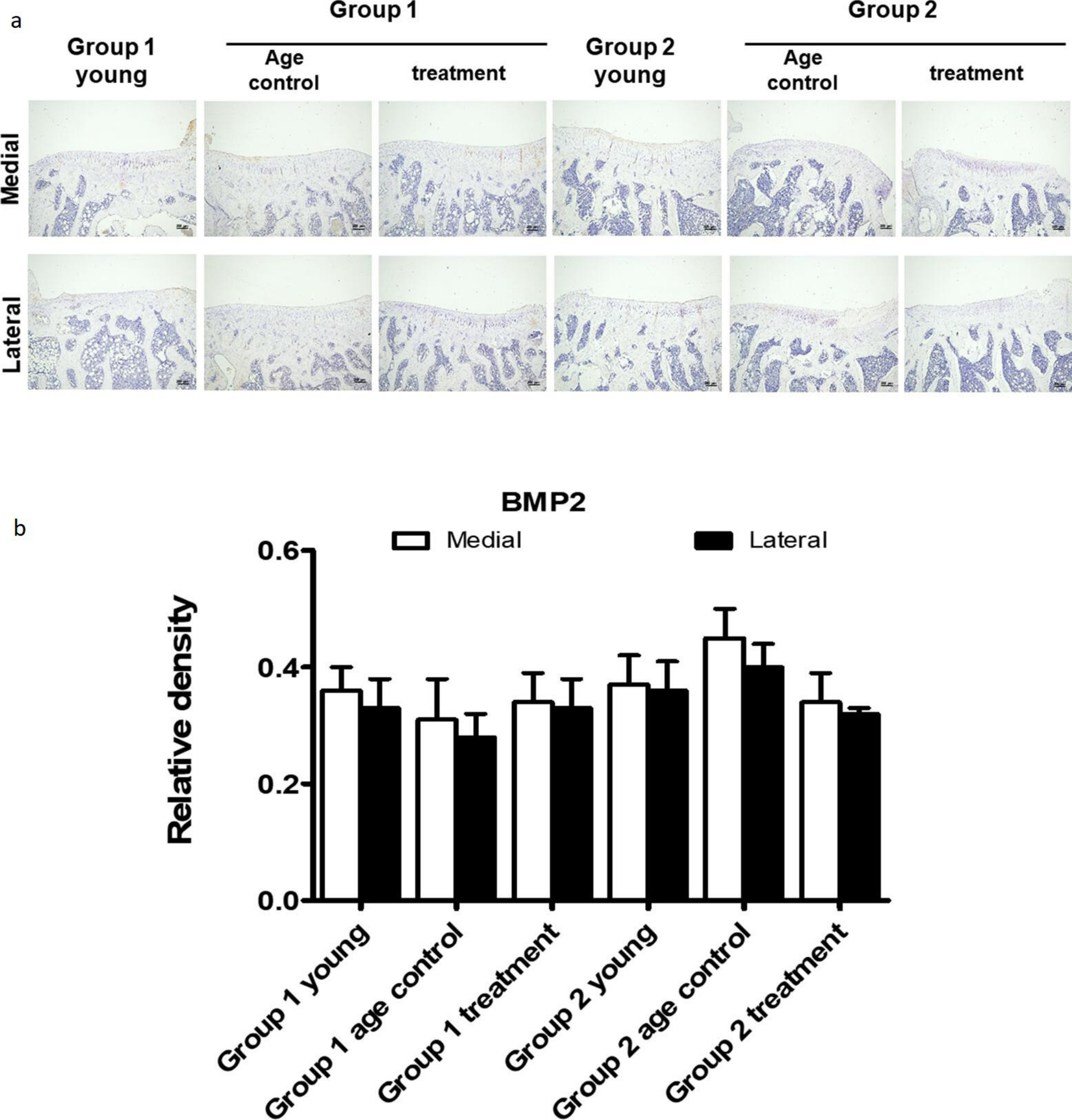 Fig. 6 
            Effect of parathyroid hormone (PTH) (1-34) on immunolocalized bone morphogenic protein (BMP)-2 in subchondral plate. At the age of six months (Group 1), guinea pigs were assigned into a control (Group 1 control; n = 7) or osteoarthritis (OA) with PTH (1-34) treatment (Group 1 treatment) group (n = 8). Another eight three-month-old guinea pigs were purchased and served as the young control group (Group 1 young; n = 8). Guinea pigs at seven months old (Group 2) were randomized into either the control (Group 2 control; n = 6) or OA with PTH (1-34) treatment (Group 2 treatment) group (n = 6). Another eight four-month-old guinea pigs were purchased and served as the young control group (Group 2 young; n = 8). All guinea pigs received treatment once per week for three months. a) Representative micrographs of immunostained BMP2 on subchondral plate from the study joints of all groups are shown. b) The relative density of BMP2 was measured and compared among groups. Each bar represents the mean and standard error of the mean of samples in each group. There was no significant difference between groups.
          