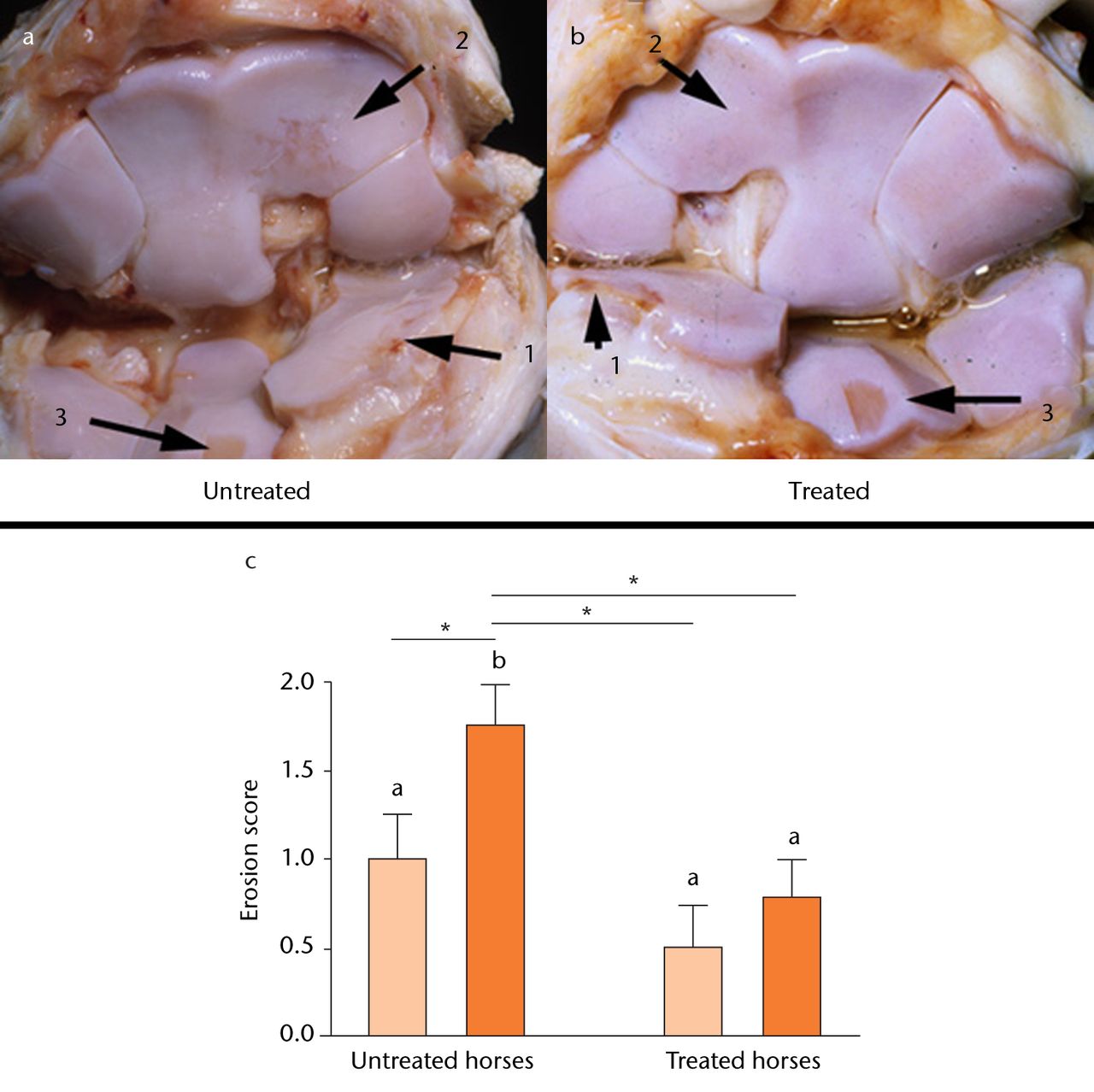 Fig. 7 
            Diagrams showing the effect of osteoarthritis
(OA) and gene transfer on cartilage erosion. Figures 7a and 7b –
photographs showing the middle carpal joint highlighting third carpal
bone lesions in OA joints of untreated horses (a) and those treated
with adenovirus-equine interleukin-1 receptor antagonist (Ad-EqIL-1Ra)
(b). Note more extensive full-thickness articular cartilage erosions
in the untreated joint (a), especially in areas of the third carpal
bone (2) not adjacent to the osteochondral fragment (1). Photos
were taken after aseptic harvest of cartilage from the intermediate
carpal bone (3). Figure 7c – bar chart showing cartilage erosion
scores by treatment group. Different letters associated with bars
indicate a statistical difference (p <
 0.05) between bars. Lines
with an asterisk (*) linking treatment groups also indicate a statistical
difference between treatment groups. For instance, there is no difference
between untreated and treated normal joints, but a significant difference
between untreated and treated OA joints (reproduced with permission
from Frisbie DD et al. Treatment of experimental equine
osteoarthritis by in vivo delivery of the equine interleukin-1 receptor
antagonist gene. Gene Therapy 2002;9:12–20).
          