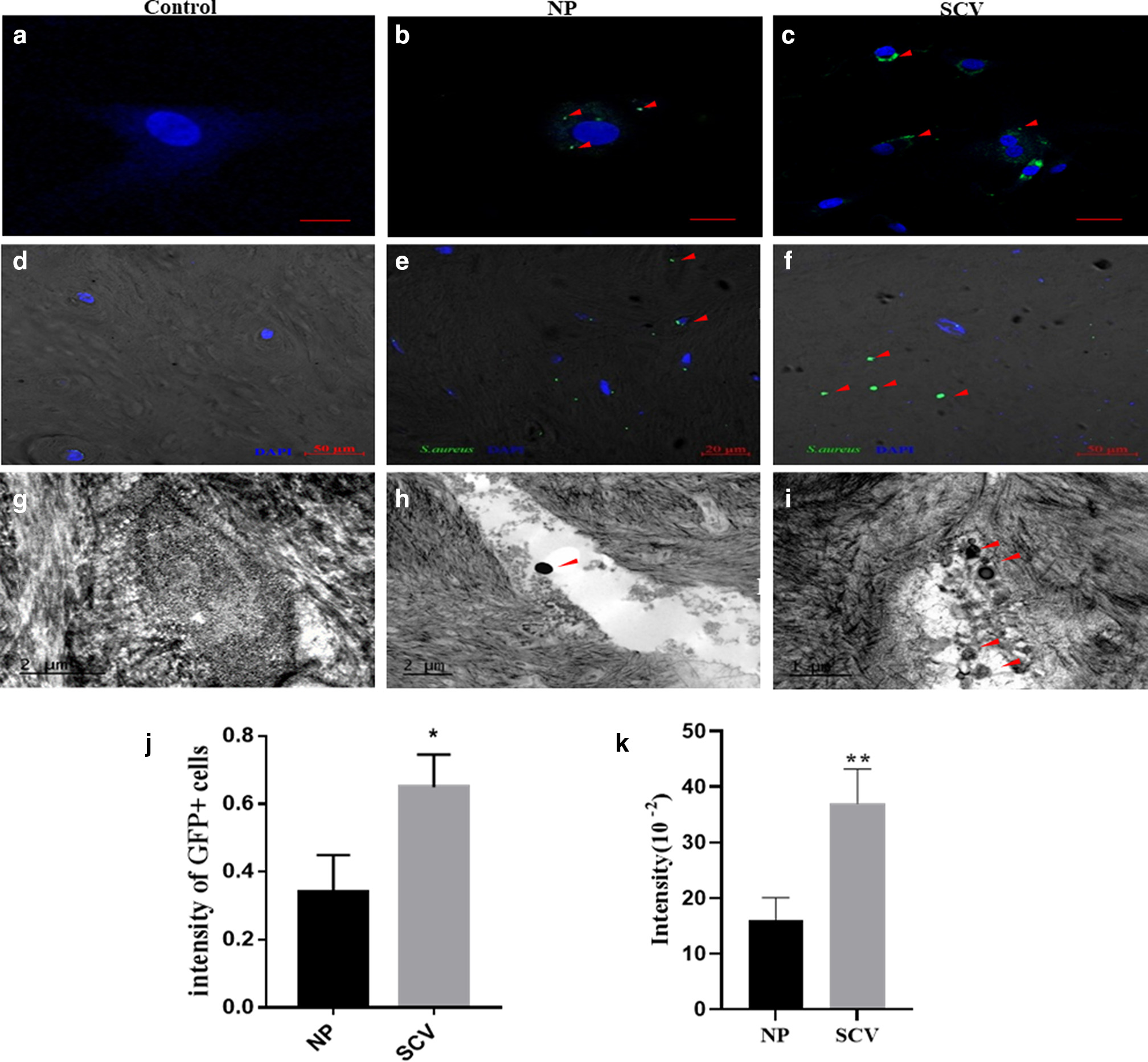 Fig. 3 
            Comparison of Staphylococcus aureus small colony variant (SCV) and normal phenotype (NP) intracellular invasion and intraosseous colonization ability. a) to c) Intracellular invasion ability detected by immunofluorescence (IF) and quantification (j). d) to f) Intraosseous colonization ability detected by IF and quantification (k), and by transmission electron microscopy (g to i). a) and b) Scale bar 20 μm; c) scale bar 50 μm; d) to f) scale bar 50 μm; g) and h) scale bar 2 μm; i) scale bar 1 μm. *p < 0.05; **p < 0.01. DAPI, 4′,6-diamidino-2-phenylindole; GFP, green fluorescence protein.
          