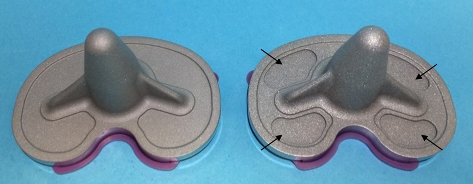 Fig. 1 
          Attune (left) and Attune S+ (right) tibia components with additional cement pockets.
        