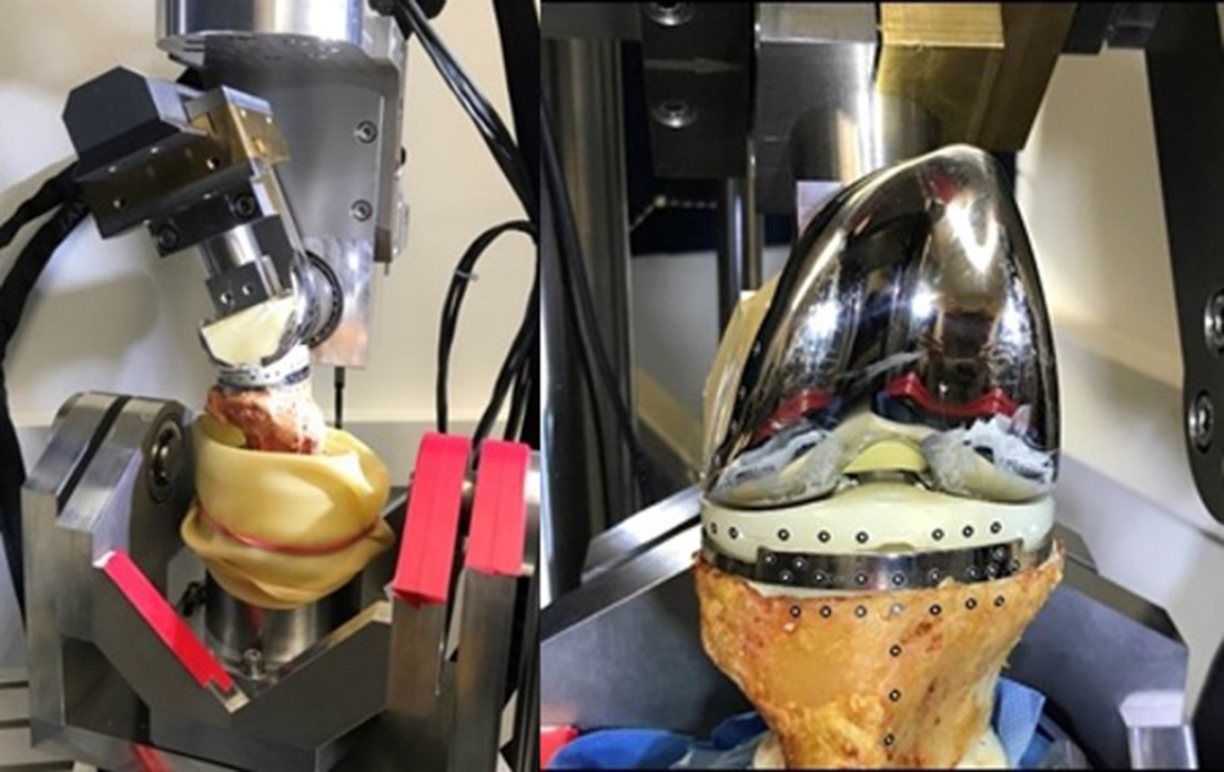 Fig. 2 
            Left: dynamic loading with extension and flexion. Right: applied bone and implant marker.
          