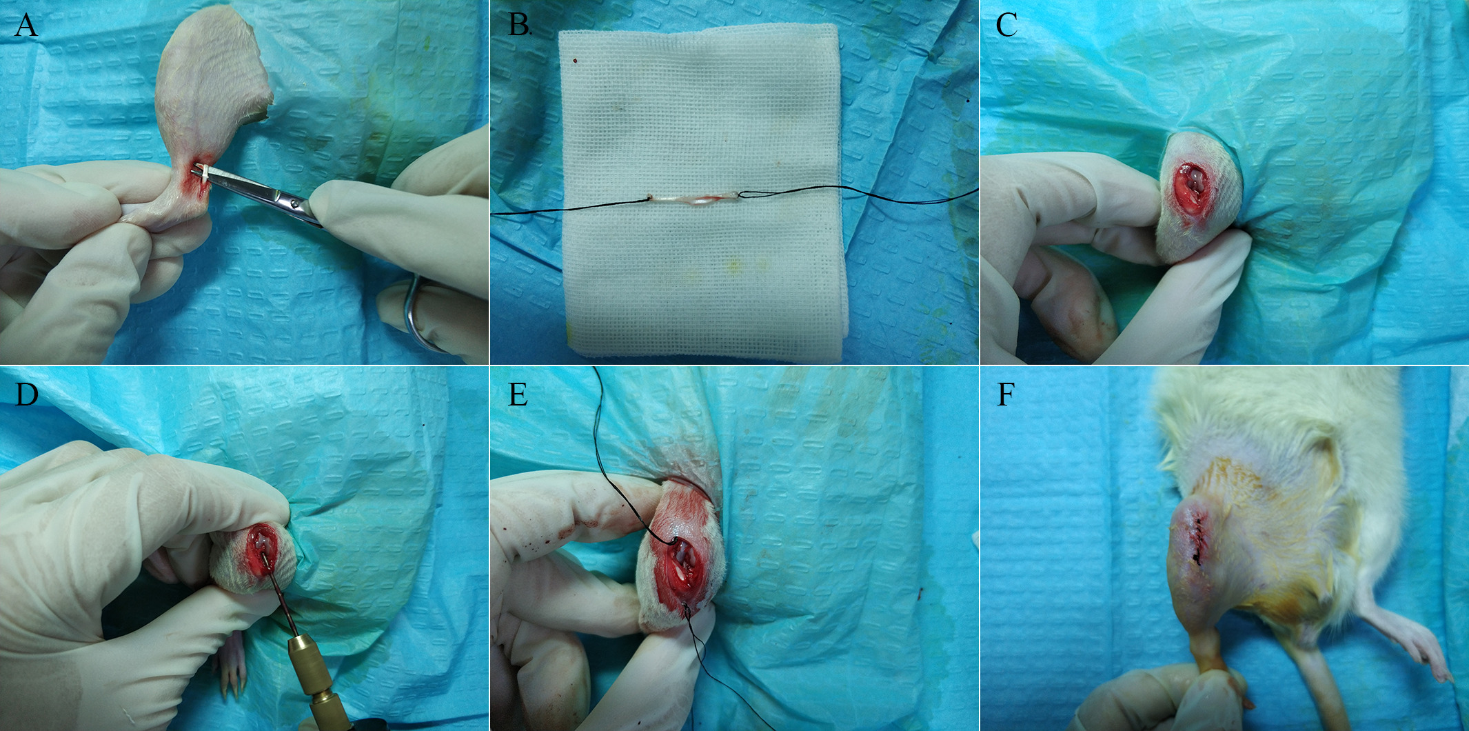 Fig. 1 
            a) and b) To create a rat model of anterior cruciate ligament (ACL) reconstruction, the rat was placed in the supine position and the flexor digitorum longus tendon was freed under aseptic conditions. c) A medial patellar incision was made to expose the knee joint and the intrinsic ACL was removed. d) A femoral tunnel was created with a drill (1 mm diameter). e) After femoral and tibial tunnels were established, both ends of the transplanted tendon were fixed and pulled into the bone tunnels. f) The incisions were sutured after injection of fibrin gel with or without recombinant secretory leucocyte protease inhibitor around the graft tendon, and the operation was completed.
          