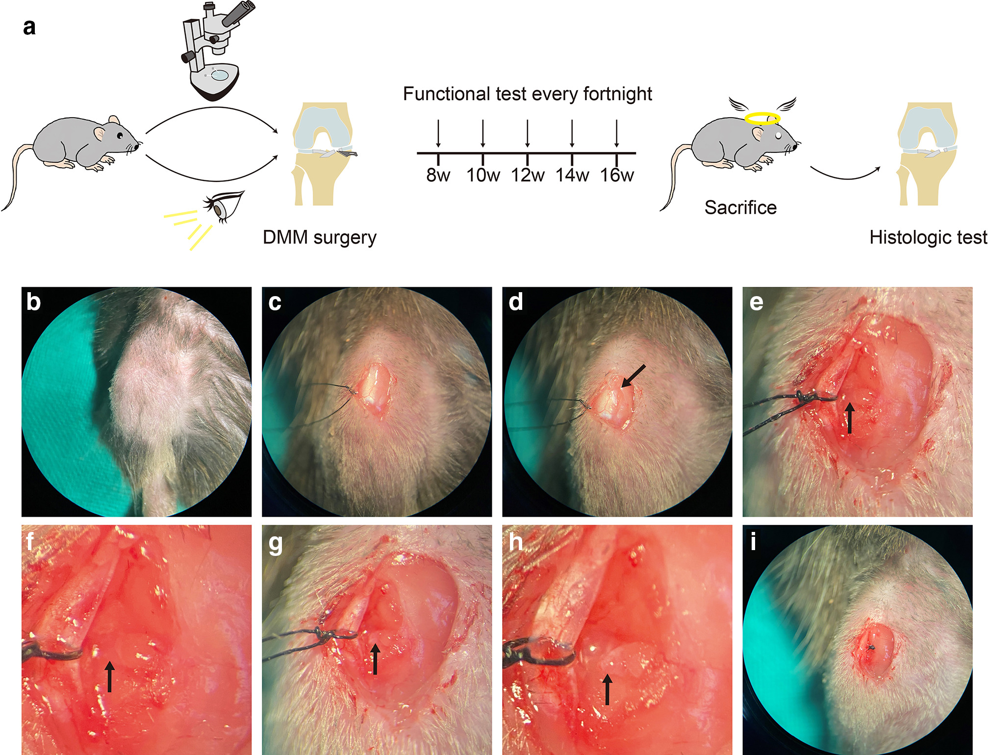 Fig. 1 
            a) General scheme of the experimental design. Mice received destabilization of the medial meniscus (DMM) surgery either with or without the aid of a stereomicroscope. Eight weeks postoperatively, static weightbearing testing and von Frey testing for hypersensitivity to pain were administered every two weeks. Mice were processed for histological evaluation at 16 weeks postoperatively. b) to i) Images of the surgical field viewed through the stereomicroscope show representative magnified views from a mouse of the microscope group (n = 30). b) Preparation of surgical site, shaved knee (right knee). c) Exposure of knee joint. d) Incision on the medial side of the patellar ligament (black arrow). e) Exposure of the medial meniscotibial ligament (MMTL, black arrow, 4× magnification). f) MMTL under high-power magnification (black arrow, 16×). g) Exposure of the articular cartilage after severing MMTL (incisal margin of MMTL, black arrow, 4×). h) Incisal margin of MMTL under high-power magnification (black arrow, 16×). i) Sutured joint capsule.
          