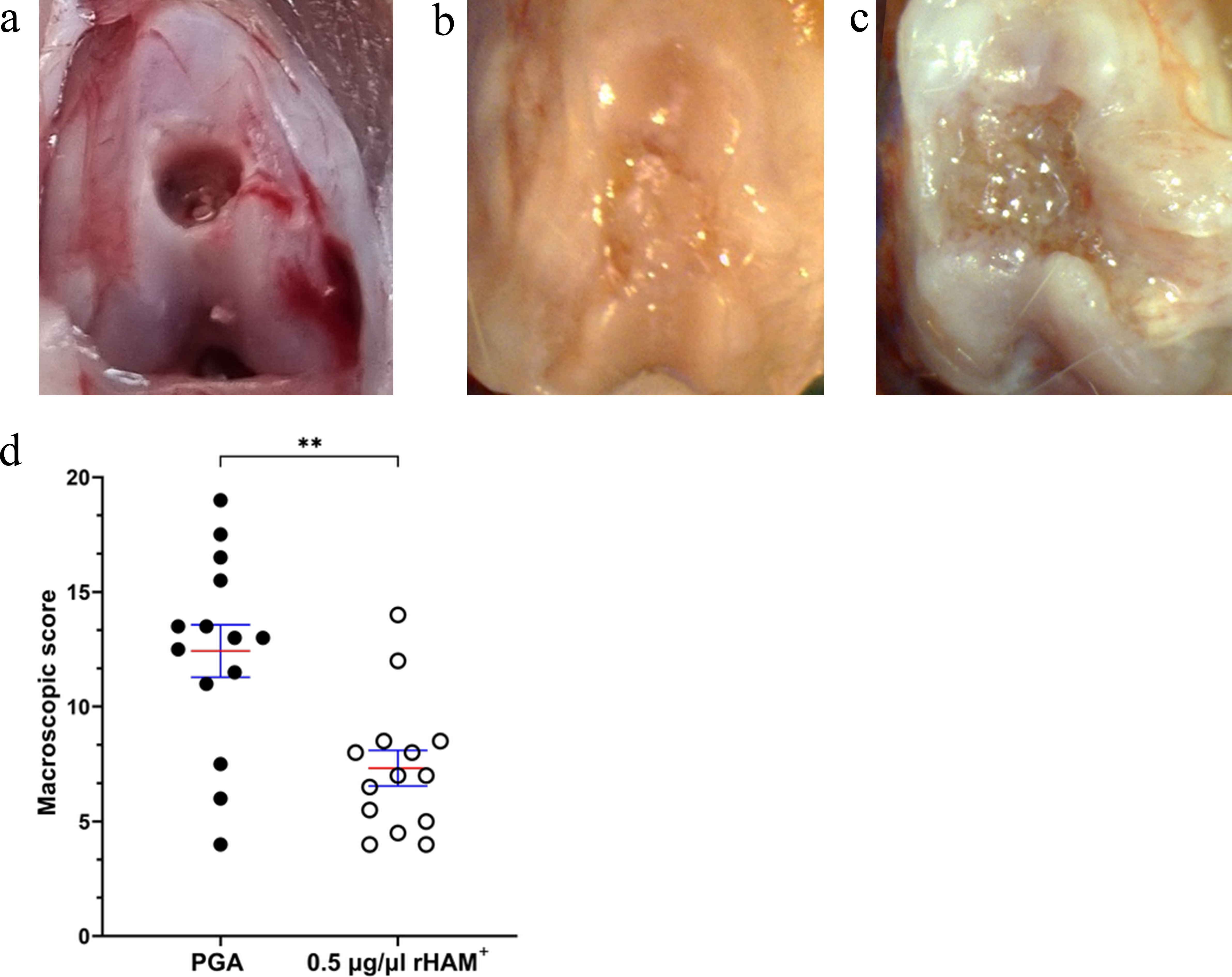 Fig. 2 
            Macroscopic evaluation of the osteochondral injury (OCI). Gross appearance of the OCI a) at the time of operation, and 12 weeks after operation and application of b) 0.5 μg/μl recombinant human amelogenin protein (rHAM+) and c) propylene glycol alginate (PGA). d) Scoring of the OCI 12 weeks after treatment with 0.5 μg/μl rHAM+ (n = 14) or PGA (n = 14), performed according to Goebel et al’s13 classification. Data are presented as mean (standard error of the mean). **p < 0.01, Mann-Whitney U test. The images represent tissues scored around mean values for each group.
          