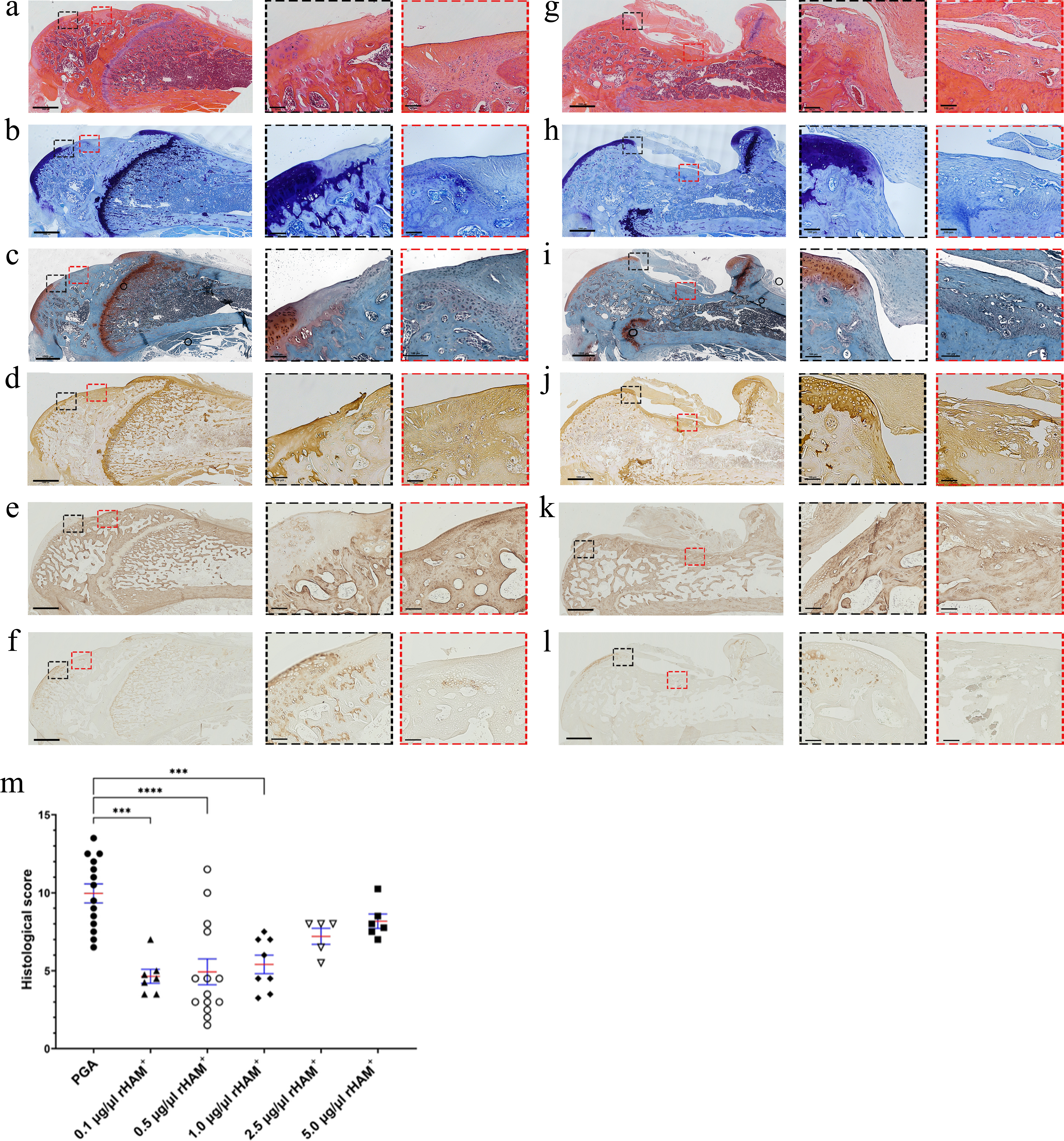 Fig. 3 
            Histological analyses of the osteochondral injury (OCI) 12 weeks after treatment, with recombinant human amelogenin protein (rHAM+) dissolved in propylene glycol alginate (PGA) or only PGA carrier. a) to f) OCI treated with 0.5 μg/μl rHAM+; g) to l) OCI treated with PGA. a) and g) haematoxylin and eosin (H&E) staining; b) and h) Toluidine blue staining; c) and i) safranin O/fast green staining. Immunohistochemistry staining was used for: d) and j) type II collagen; e) and k) type I collagen; and f) and i) type X collagen. Scale bar: 100 μm. Enlarged pictures (×10) were taken from the regions marked with red and black frames. Black frames represent the edge of the defect, while red frames represent the centre of the OCI. m) Histological grading of the OCI after treatment with 0.1 μg/μl rHAM+ (n = 7), 0.5 μg/μl rHAM+ (n = 14), 1.0 μg/μl rHAM+ (n = 8), 2.5 μg/μl rHAM+ (n = 5), 5.0 μg/μl rHAM+ (n = 6), and PGA alone (n = 14). Grading was performed according to Pineda et al’s scoring system.14 Data are presented as mean (standard error of the mean). ***p < 0.001, ****p < 0.0001; Kruskal-Wallis one-way analysis of variance. The images represent tissues scored around mean values and were taken from the same rats presented in Figure 2.
          