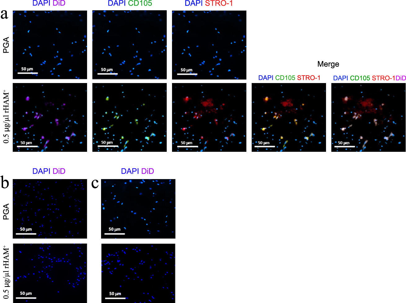 Fig. 5 
            In vivo cell tracking four days after creation of an osteochondral injury (OCI) at the rat’s knee, and treatment with 0.5 μg/μl recombinant human amelogenin protein (rHAM+) or with propylene glycol alginate (PGA) carrier. Following the creation of an OCI at the rat’s knee, DiD was injected into a hole drilled a) 0.5 cm proximal or b) 1.5 cm proximal to the OCI in the ipsilateral femur, or c) to the peritoneal fat pad (total six groups, n = 4 per group). Immunofluorescence staining was performed as depicted in the heading of each image. Cell nuclei were stained with 4’,6-diamidino-2-phenylindole (DAPI). Staining for DiD, CD105, and STRO-1 was observed only in the picture taken from the OCI when DiD was injected 0.5 cm proximal to the defect. Scale bar: 50 μm.
          