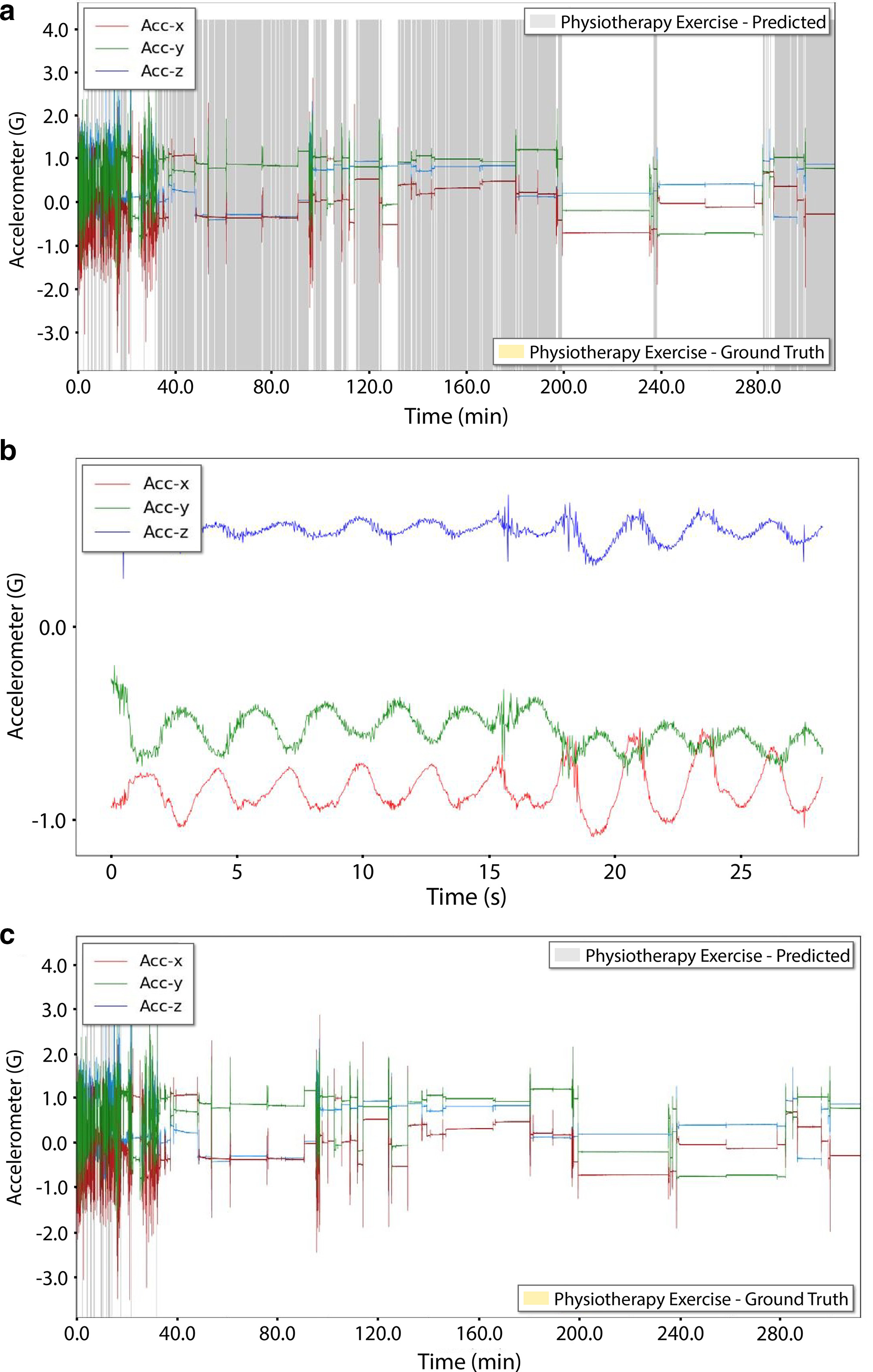 Fig. 5 
            a) This record shows > five hours of data that appear to consist entirely of non-exercise, most of which is incorrectly predicted as exercise by the patient-specific method with engineered features without proxy (specificity 0.445). When the supervised labelled press-up record of b) is removed from the support set for this record, the resulting improvement is shown in c) (specificity 0.985). Note that it was not only this particular press-up record that caused this issue, but also any previous press-up exercises that the patient performed in clinic at earlier dates that were substituted in support.
          