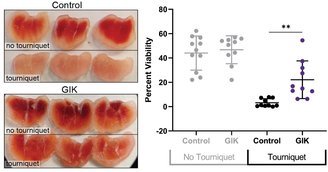 Fig. 1 
          Representative images of the gastrocnemius triphenyltetrazolium (TTC) stain and quantification of the gastrocnemius TTC stain demonstrating significantly greater TTC stain in the glucose-insulin-potassium (GIK) cohort compared to the control cohort tourniqueted limbs (22.1% (n = 10) vs 3.1% (n = 10), p = 0.006). **p ≤ 0.01.
        