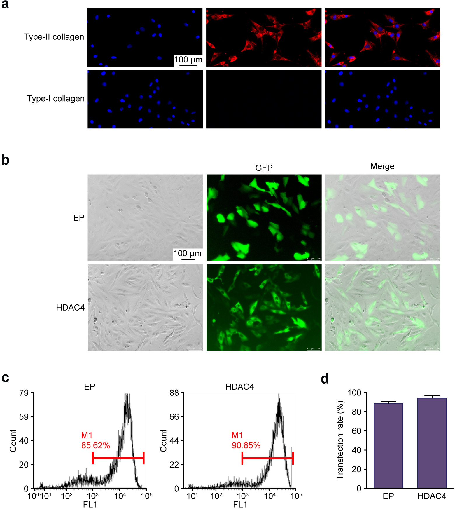 Fig. 1 
            a) Immunofluorescence assay results showed that cells were positive for type II collagen (red) and negative for type I collagen (red, scale bar: 100 μm). b) The transfection efficiency in each group was observed by fluorescence microscopy. The empty adenovirus (EP) and histone deacetylase 4 (HDAC4) adenoviruses carried green fluorescent protein (GFP) (green); scale bar: 100 μm. c) Representative transfection rate of groups at 48 hours after transfection by flow cytometry. d) Data were quantified by the mean transfection rate (n = 3). FL1, FITC channel; M1, FITC positive cell rate.
          