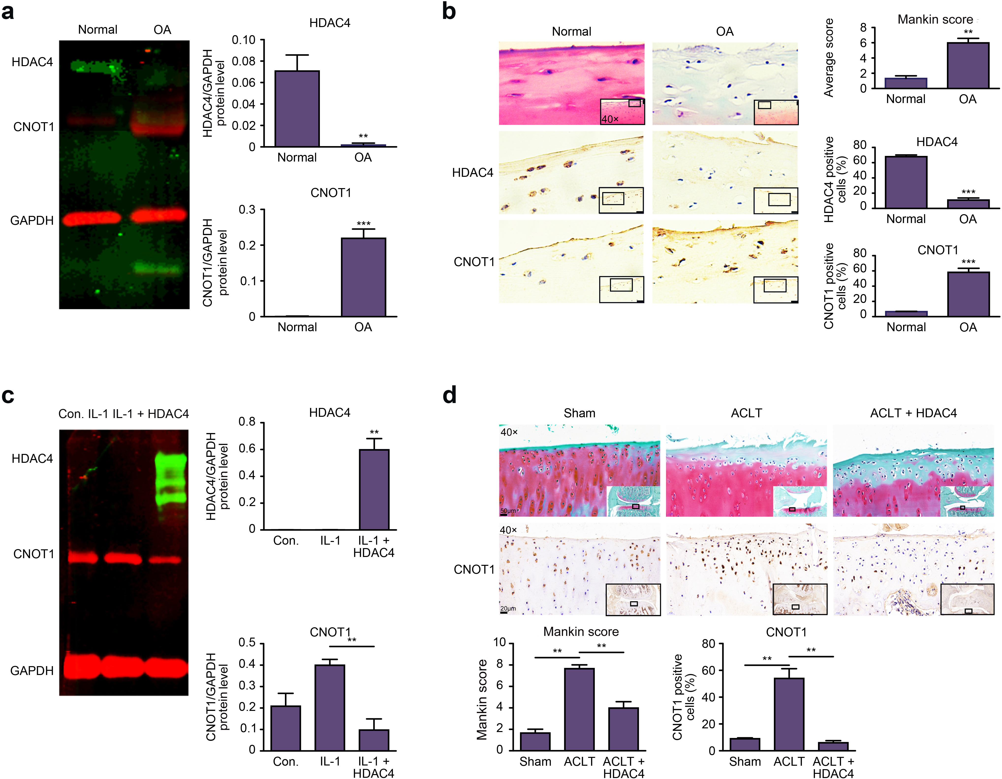 Fig. 7 
            a) The protein level of CNOT1 in normal and osteoarthritis (OA) cartilage tissue was detected by Western blotting (n = 3). b) The protein expression of CNOT1 in relatively normal and OA cartilage tissue was detected by immunohistochemistry (n = 3). c) Western blotting results showed the protein level of CNOT1 in the OA chondrocyte model (n = 3). d) Safranin O and fast green staining showed the degenerative degree of cartilage tissue, and immunohistochemistry results showed the protein expression of CNOT1 in OA rat models (n = 10). The data are expressed as the mean (standard deviation). **p < 0.01, ***p < 0.001. ACLT, anterior cruciate ligament transection; Con., control; IL, interleukin; GAPDH, glyceraldehyde 3-phosphate dehydrogenase; HDAC4, histone deacetylase 4.
          