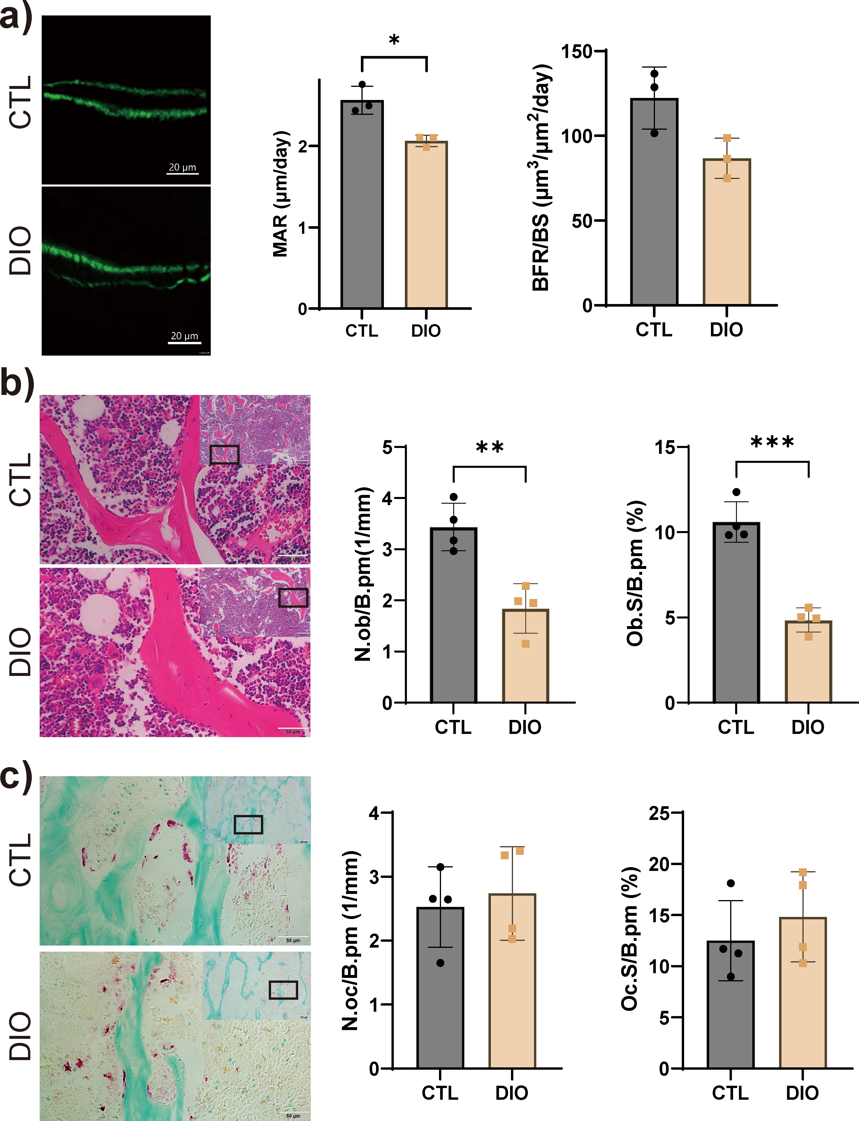 Fig. 2 
            Obesity negatively regulates bone formation. a) Cancellous bone formation showed a significant decrease in the mineral apposition rate (MAR) as determined using a calcein double-labelling assay (n = 4). Magnification: 1,124×. b) Osteoblasts were detected by haematoxylin and eosin (H&E) staining and quantified; number of osteoblasts (N.Ob/B.Pm) and percentage of bone surface occupied by osteoblasts (Ob.S/B.Pm) were significantly decreased (n = 4). Magnification: 100× (top), 400× (bottom). c) Osteoclasts were detected by tartrate acid phosphatase (TRAP) staining and quantified; no difference in number of osteoclasts (N.Oc/B.Pm) or the percentage of bone surface occupied by osteoclasts (Oc.S/B.Pm) was detected (n = 4). Magnification: 100× (top), 400× (bottom). Data are expressed as means and standard deviations. *p < 0.05, **p < 0.01, ***p < 0.001 compared with CTL (independent-samples t-test). BFR/BS, bone formation rate; CTL, control; DIO, diet-induced obese.
          