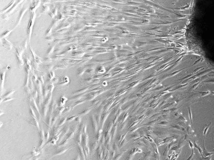 Figs. 2a - 2c 
            Figures 2a and 2b – photomicrographs
showing hamstring tendon explants in the culture environment in
a) control tissue, showing tenocytes migrating from various points
of the explants, which then continued to migrate and proliferate,
and b) in tissue exposed to the gentian violet ink marker, showing
no cell migration. Figure 2c – histogram comparing mean cell migration between
the control and inked tissues, showing a statistically significant
difference (* p = 0.0182). The error bars show the standard error
of the mean.
          