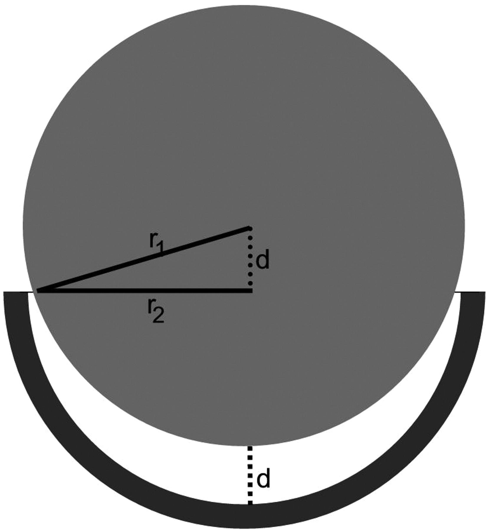 Fig. 1 
            Cross-sectional diagram of a metal-on-metal
hip resurfacing (diameter 55 mm) showing how the linear separation
between the femoral and acetabular -components (d) was calculated
at various circumferential separation distances.
          