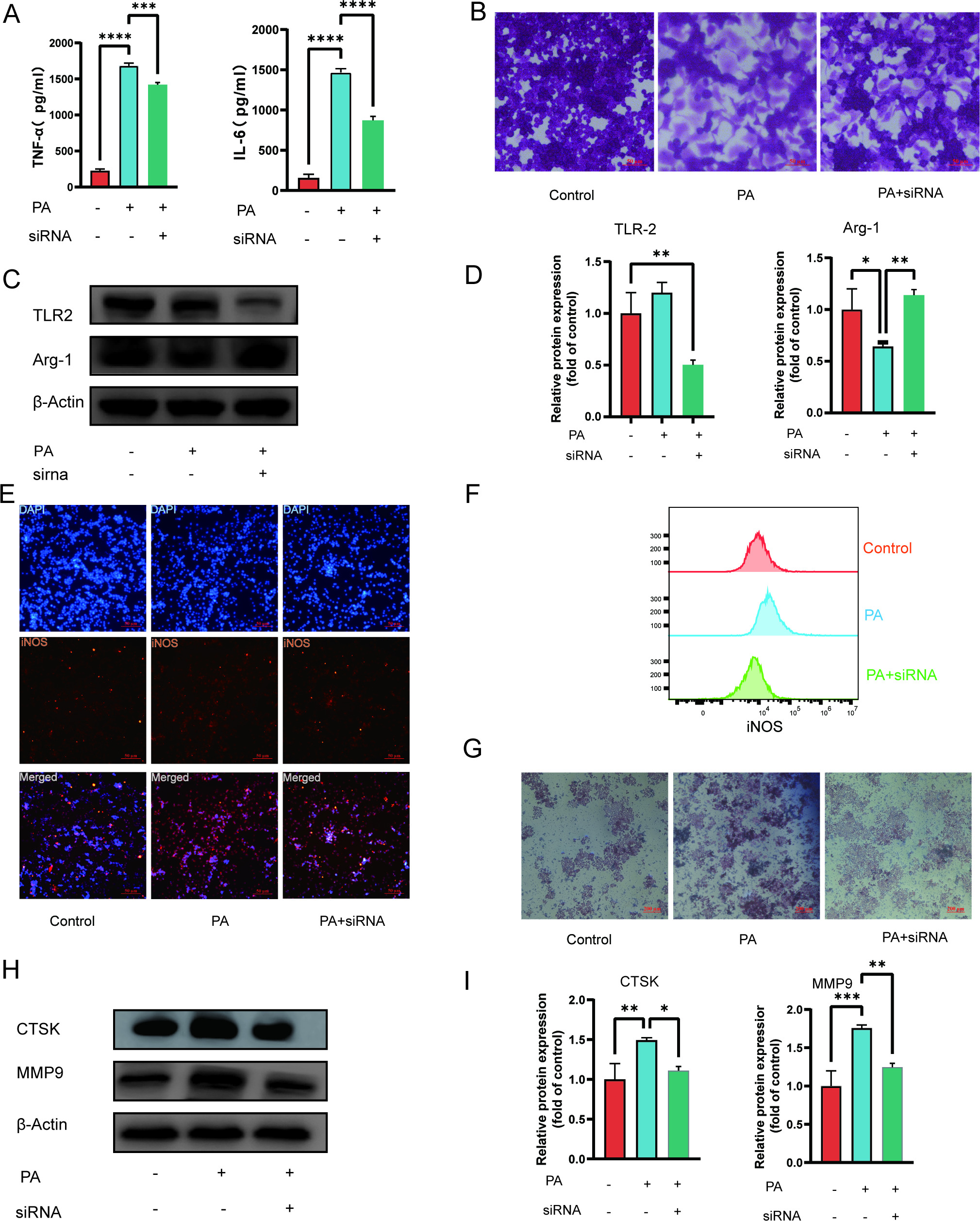 Fig. 6 
            Elevated expression of Toll-like receptor 2 (TLR2) in macrophages precipitates the onset of obesity and osteoporosis. a) Following transfection, the secretion levels of interleukin (IL)-6 and tumour necrosis factor-α (TNF-α) in the supernatant were quantified using enzyme-linked immunosorbent assay (ELISA). b) Alterations in macrophage morphology were observed before and after treatment with palmitic acid (PA) and small interfering RNA (siRNA)-TLR2. Produced with crystal violet staining, magnification 200×. c) At the protein level, evaluate the silencing efficiency of TLR2 and the expression levels of ARG1. d) The protein expression of TLR2/ARG1 compared with the control group was examined. e) After treating macrophages with PA and siRNA-TLR2, we observed that the localization and expression of iNOS was in a more aggregated state. f) Fluorescence intensity of iNOS was detected using flow cytometry. g) Upon staining cells with tartrate-resistant acid phosphatase (TRAP), the number of multinucleated cells increased in the PA-induced group. This change was reversed in the siRNA-TLR2 group. h) We employed Western blot analysis to detect the expression of proteins associated with osteoclast differentiation. i) The protein expression of Cathepsin K (CTSK)/matrix metalloproteinase-9 (MMP9) compared with the control group was examined. Data are shown as mean and SD. *p < 0.05, **p < 0.005, ***p < 0.001 compared with control cells, calculated with one-way analysis of variance. All representative data from three independent experiments are shown.
          