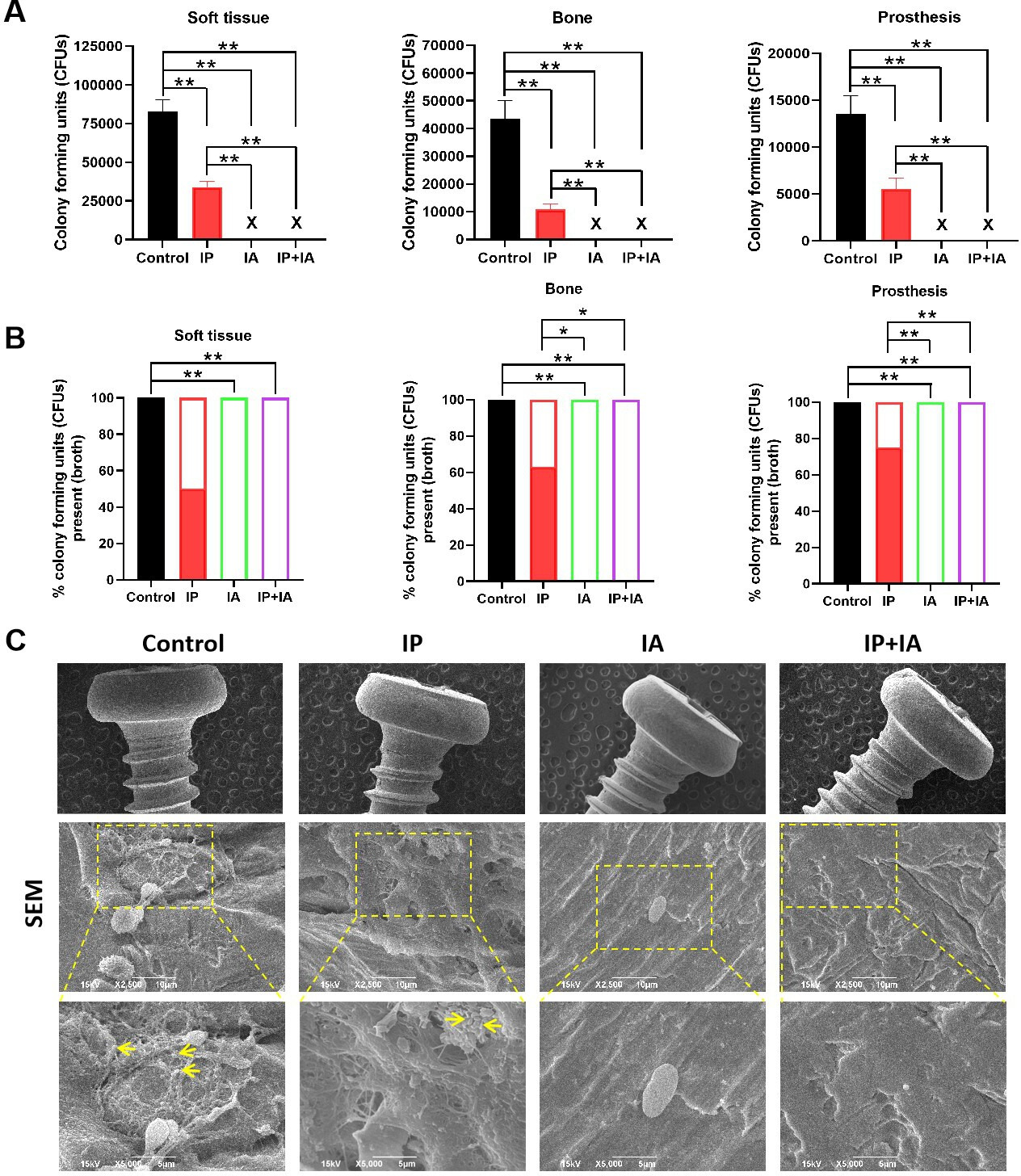 Fig. 3 
            
              Escherichia coli (E. coli) load in the soft-tissue, bone, and prostheses from periprosthetic joint infection (PJI) rats two weeks after one-stage revision. a) Colony-forming units (CFU)/ml of E. coli isolated from the soft-tissue, bone, and prostheses. b) Percentages of cultures showing growth of E. coli isolated from the soft-tissue, bone, and prostheses. N = 8 per group. *p < 0.05, **p < 0.01; non-parametric Mann-Whitney U test for the comparison of colony counts between different treatment conditions, and Fisher’s exact test for the comparison of the percentages of cultures that had any bacterial growth. c) Representative scanning electron microscopy (SEM) images showing biofilm formation on the prostheses in three meropenem groups (intra-articular (IA), intraperitoneal (IP), and IP + IA) and PJI control group (all treated with E. coli to induce PJI). N = 3 per group. The arrows point to E. coli cells.
          