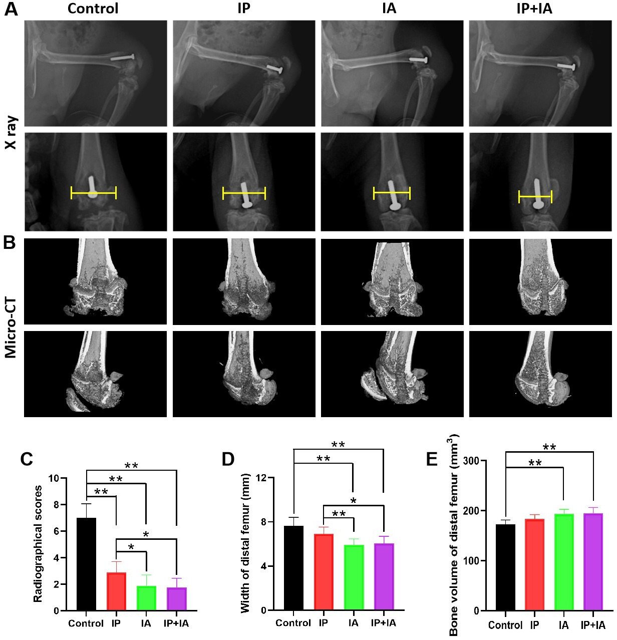 Fig. 4 
            Radiological evaluation of the knee joint in periprosthetic joint infection rats at two weeks after one-stage revision. a) Representative anteroposterior radiograph images. b) 3D CT scans and distal femur reconstruction. c) Radiological scores indicating bone damage based on radiograph images. d) Quantitative analysis of distal femur width. e) Quantitative analysis of distal femur bone volume. N = 8 per group. *p < 0.05, **p < 0.01; one-way analysis of variance with Tukey’s multiple comparison test, or Kruskal-Wallis test with Dunn’s multiple comparison test. IA, intra-articular; IP, intraperitoneal.
          