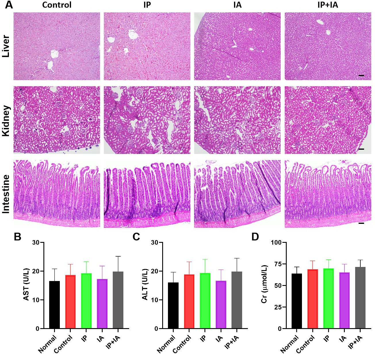 Fig. 6 
            Photographs of haematoxylin and eosin (H&E)-stained liver, kidney, and intestine sections, and liver and kidney biochemical indicators in periprosthetic joint infection rats. a) H&E-stained liver, kidney, and intestine sections. b) to d) Serum aspartate aminotransferase (AST), alanine aminotransferase (ALT), and Cr levels. “Normal” indicates normal serum biochemical values before surgery. N = 8 per group. Scale bar, 100 μm (top panels) or 50 μm (middle and bottom panels). IA, intra-articular; IP, intraperitoneal.
          