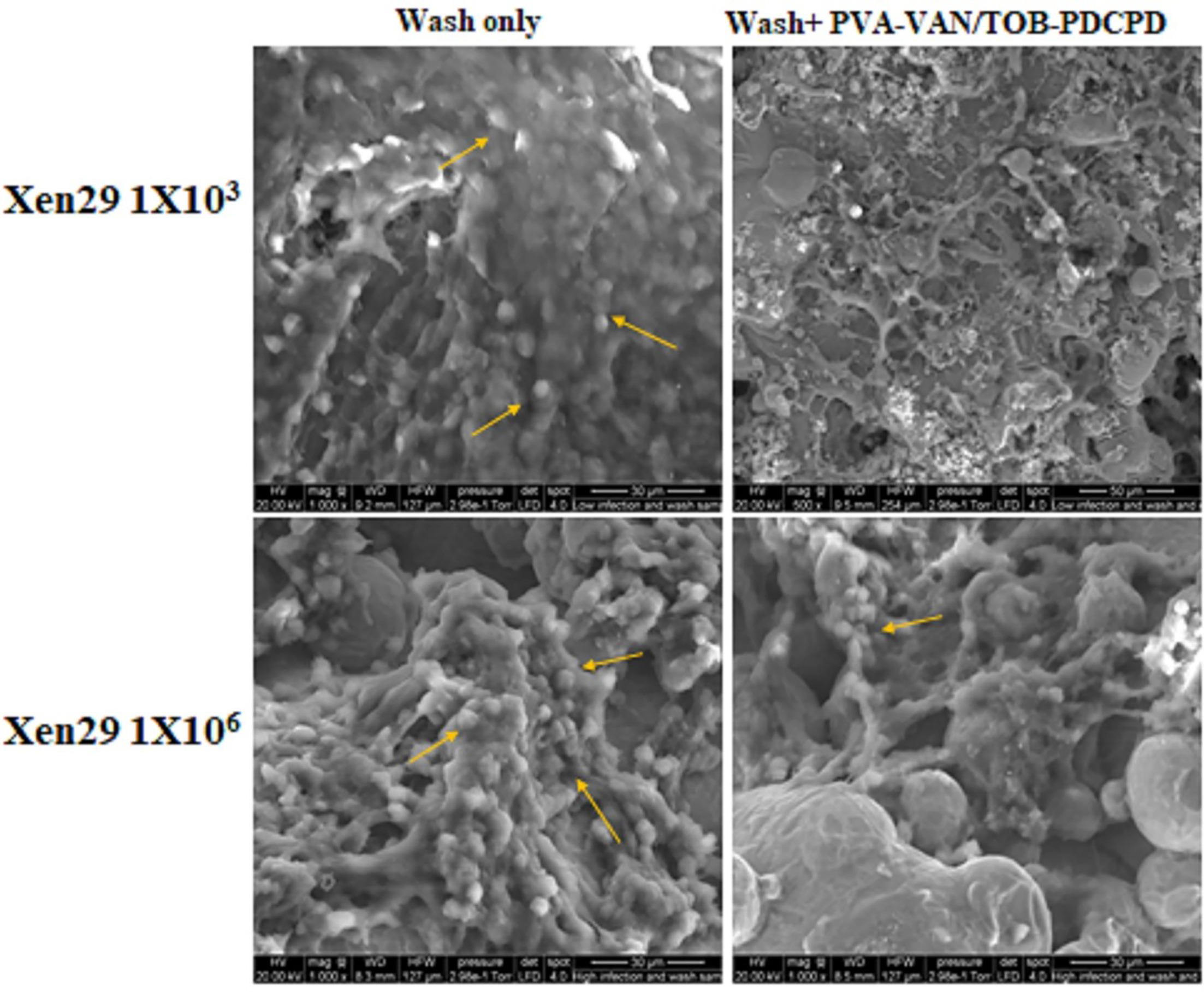 Fig. 9 
            Comparison of scanning electron microscopy morphology of titanium cylinder surface between wash only and wash with PVA-VAN/TOB-PDCPD (n = 1 from each group). Arrows indicate the accumulation of bacterial cluster and biofilm formation.
          