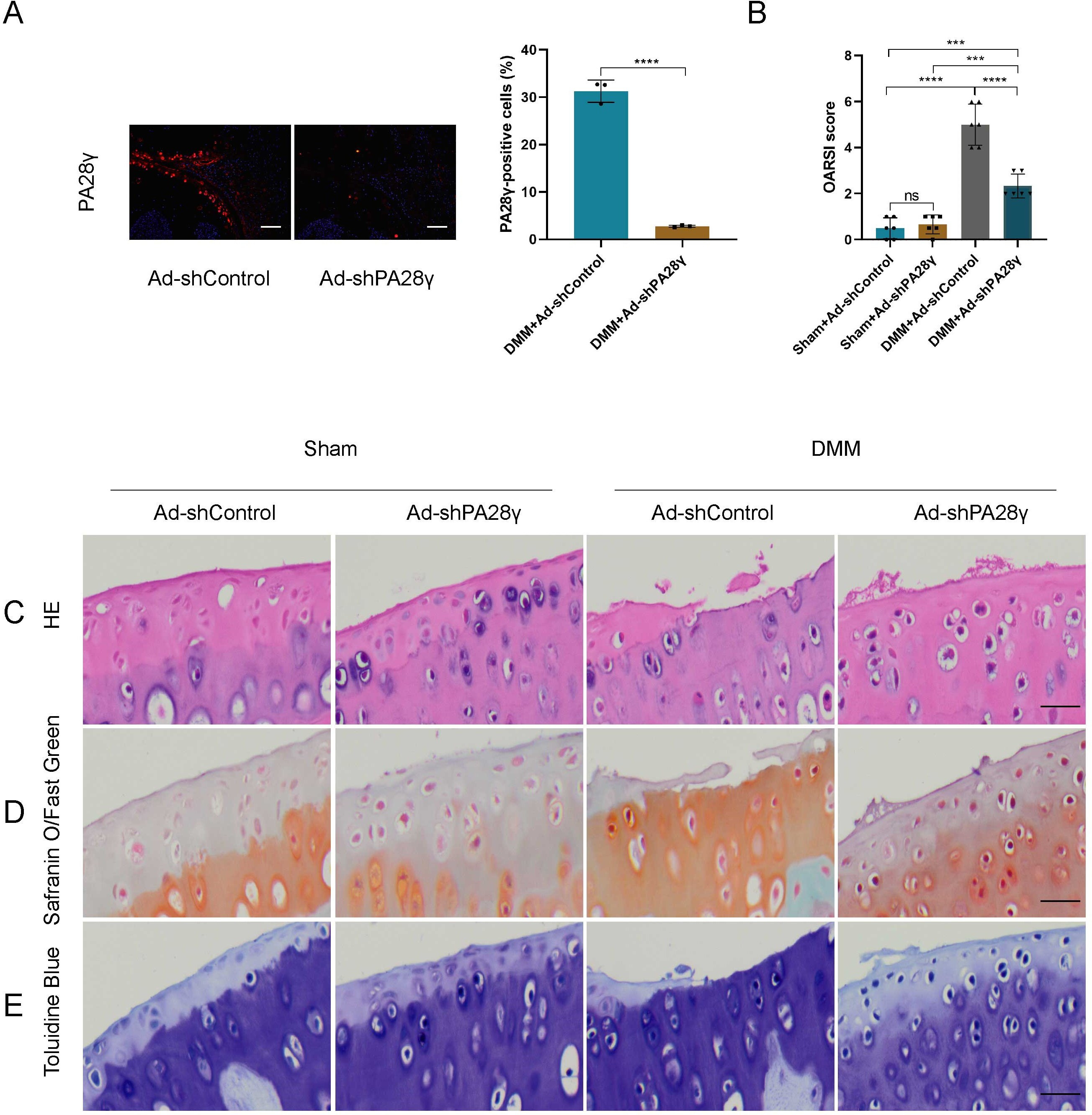 Fig. 7 
            Knockdown of PA28γ alleviates osteoarthritis (OA) after destabilized medial meniscus (DMM) surgery. a) PA28γ representative immunofluorescence staining images and quantitative data of knee joint tissue obtained from Ad-shControl and Ad-shPA28γ mice eight weeks after DMM surgery, measuring scale = 100 μm, magnification: ×200 (n = 3, ****p < 0.0001). b) Osteoarthritis Research Society International (OARSI) score of mouse knee joint (n = 6, ***p < 0.001, ****p < 0.0001). c) Haematoxylin and eosin (HE) staining images of knee joint tissue obtained from Ad-shControl and Ad-shPA28γ mice eight weeks after DMM surgery, measuring scale = 100 μm. d) Safranin O/solid green staining images of knee joint tissue obtained from Ad-shControl and Ad-shPA28γ mice eight weeks after DMM surgery, measuring scale = 100 μm. e) Toluidine blue staining images of knee joint tissue obtained from Ad-shControl and Ad-shPA28γ mice eight weeks after DMM surgery, measuring scale = 100 μm, magnification: ×400.
          