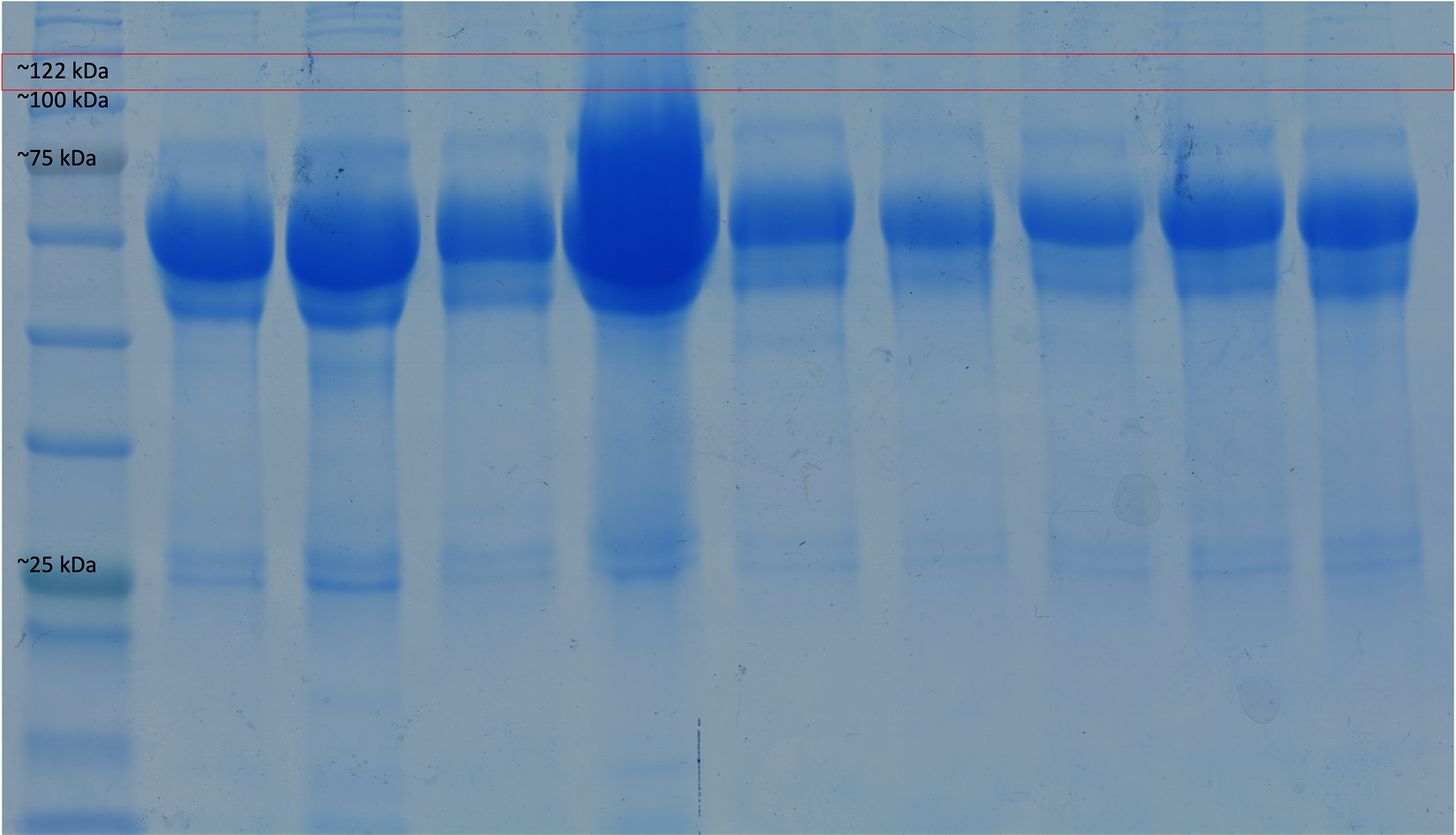 Fig. 10 
            Sodium dodecyl-sulphate polyacrylamide gel electrophoresis (SDS-PAGE) and protein identification in synovial fluid run for 90 minutes. Upon completion, the gel was removed from the dock and stained overnight with Instant Blue Coomassie Protein Stain. After staining the gel, we used an automated spot picker to identify the individual protein bands from the gel. The red box identifies the heterogeneous band in the different synovial fluid samples compatible with the estimated size of ceruloplasmin (122 kDa).
          