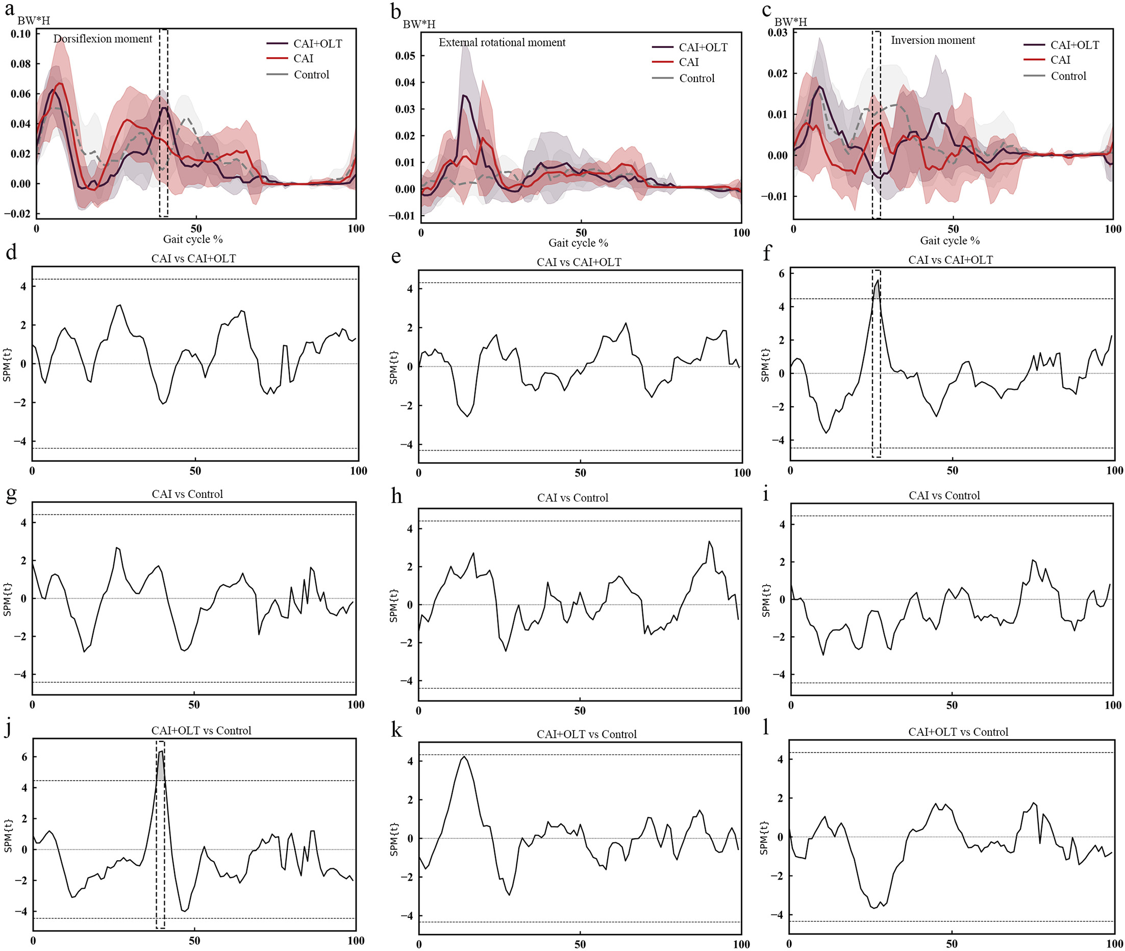 Fig. 3 
          Ankle moments during a stair descent gait cycle from the initial contact of the injured leg on the second step to the initial contact of the injured leg on the ground level. a) and b) Mean ankle dorsiflexion/plantarflexion, internal/external rotational, and inversion/eversion moments with standard deviation clouds during a stair descent gait cycle. Positive values indicate moments in the dorsiflexion, external rotation, and inversion directions. d) to l) Statistical parametric mapping analysis results showing that the comparisons in Figures 3f and 3j reached statistical significance, as indicated by the dashed lines above and below 0. The boxed area represents the area of statistical significance between the two groups. BW, body weight; CAI, patient with chronic ankle instability without osteochondral lesion of the talus; CAI+OLT, patient with chronic ankle instability and osteochondral lesion of the talus; H, height.
        