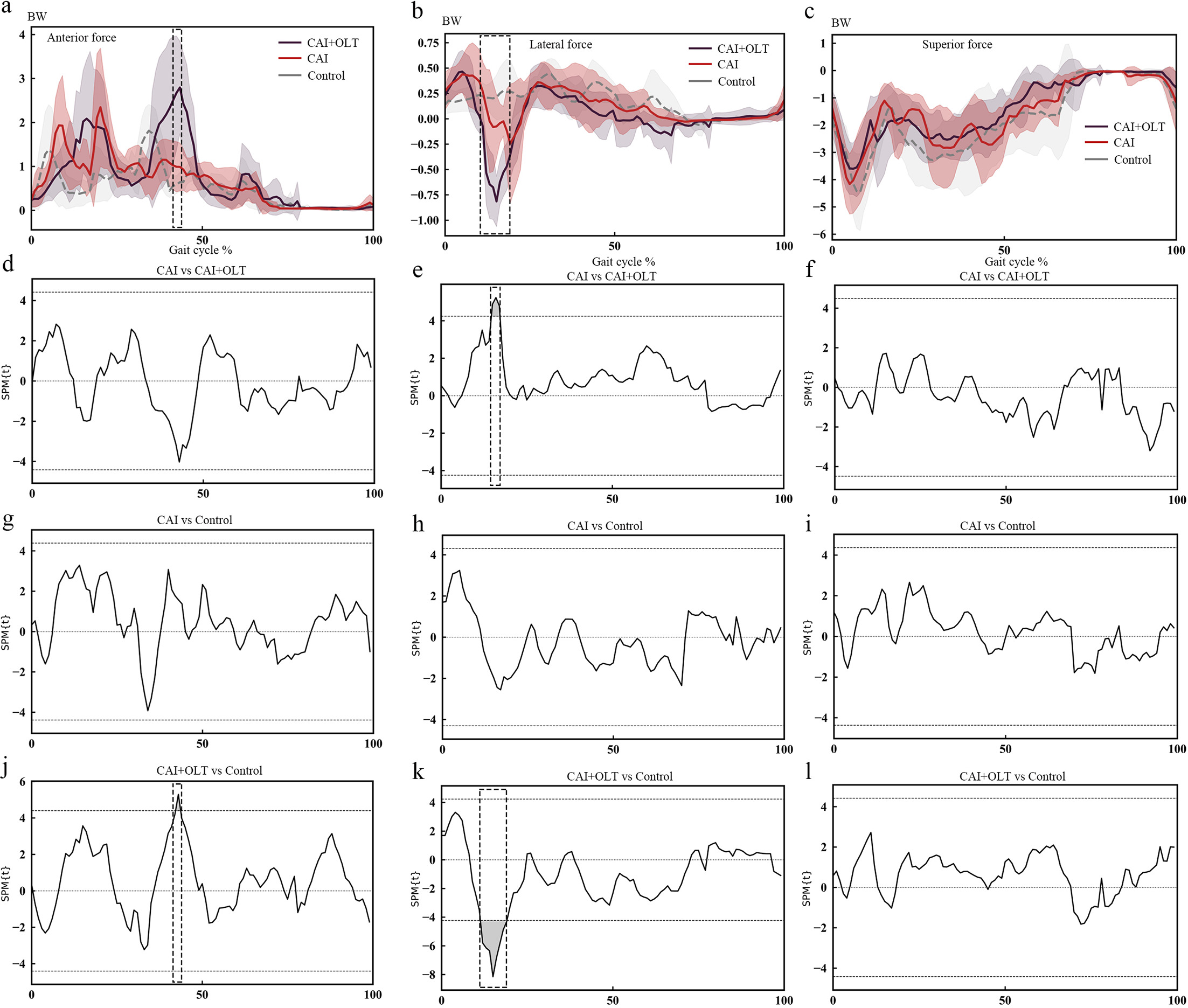 Fig. 4 
          Ankle joint reaction forces during a stair descent gait cycle from the initial contact of the injured leg on the second step to the initial contact of the injured leg on the ground level. a) to c) Mean ankle anterior/posterior, lateral/medial, and superior/inferior forces with standard deviation clouds during a stair descent gait cycle. Positive values indicate forces in anterior, lateral, and superior directions. d) to l) Statistical parametric mapping analysis results showing that the comparisons in Figures 4e, 4j, and 4k reached statistical significance, as indicated by the dashed lines above and below 0. The boxed area represents the area of statistical significance between the two groups. BW, body weight; CAI, patient with chronic ankle instability without osteochondral lesion of the talus; CAI+OLT, patient with chronic ankle instability and osteochondral lesion of the talus.
        