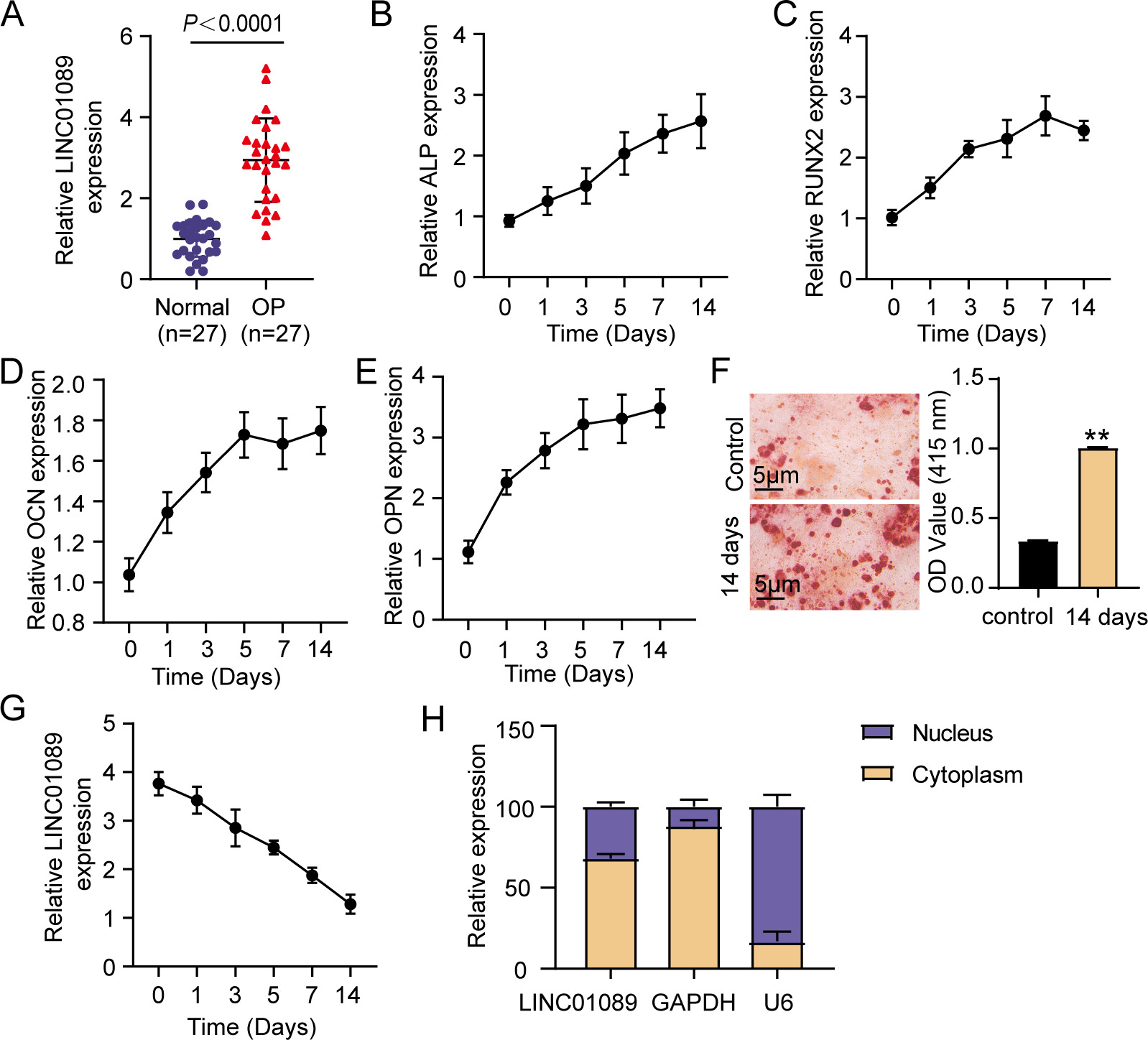 Fig. 1 
            LINC01089 was highly expressed in osteoporosis (OP)-derived serum samples, and its expression gradually diminished while the human mesenchymal stem cells (hMSCs) underwent osteogenic differentiation. a) LINC01089 expression in clinical samples from OP patients and normal subjects. b) to e) The levels of alkaline phosphatase (ALP), runt-related transcription factor 2 (RUNX2), osteocalcin (OCN), and osteopontin (OPN) messenger RNAs (mRNAs) in osteogenic differentiation-induced hMSCs. f) Alizarin red S (ARS) staining and quantitative analysis of calcium mineral deposition in osteogenic differentiation-induced hMSCs. **p < 0.001, one-way analysis of variance. g) LINC01089 expression in osteogenic differentiation-induced hMSCs. h) Subcellular location of LINC01089. GAPDH, glyceraldehyde 3-phosphate dehydrogenase; OD, optical density.
          