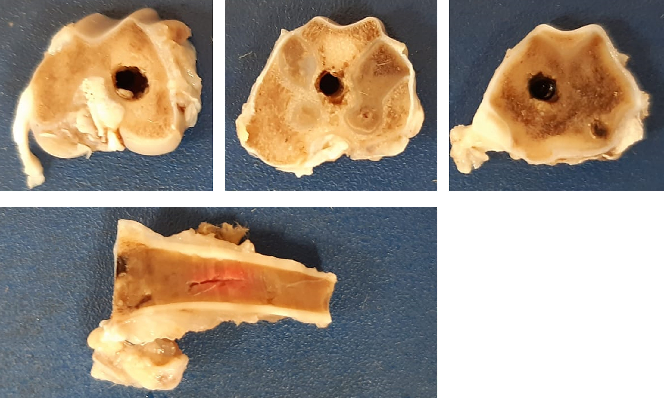 Fig. 4 
            Distal femur sections were cut transversally 4, 7, and 14 mm from distal apex, and sagitally containing the screw track.
          