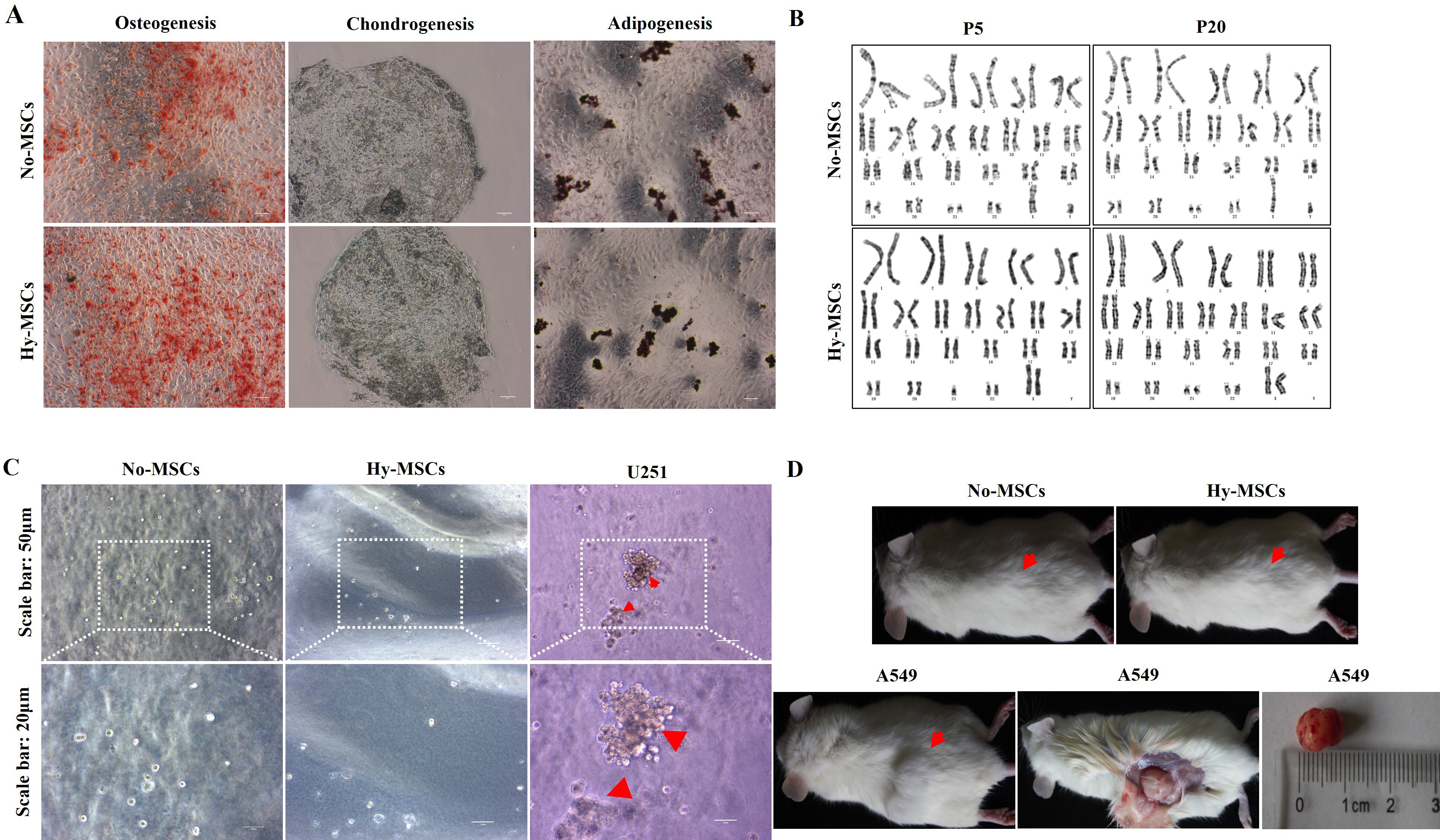 Fig. 3 
            The multilineage differentiation, tumorigenicity, and karyotypes of human umbilical cord-derived mesenchymal stem cells (hUC-MSCs) in long-term hypoxic atmosphere. a) The differentiative potential of both hUC-MSCs cultured with normoxic atmosphere (No-MSCs) (P5) and hypoxic hUC-MSCs (Hy-MSCs) (P5) was shown through staining by Alizarin Red, Oil Red-O, and Alcian Blue, respectively, including in osteoblasts, chondrocytes, and adipocytes. Scale bar: 50 μm. b) The karyotypes of hUC-MSCs (P5 and P20) were measured by G-banding assay. c) Both No-MSCs and Hy-MSCs (P5) were analyzed for tumour formation in soft agar cloning experiments, and glioma cell line (U251) was used as a control. d) Both No-MSCs and Hy-MSCs (P5) were analyzed for tumour formation in immunodeficient mice (NOG), and lung cancer cell line (A549) was used as a control. The experiments were repeated three times independently, and the data of one representative experiment were shown.
          