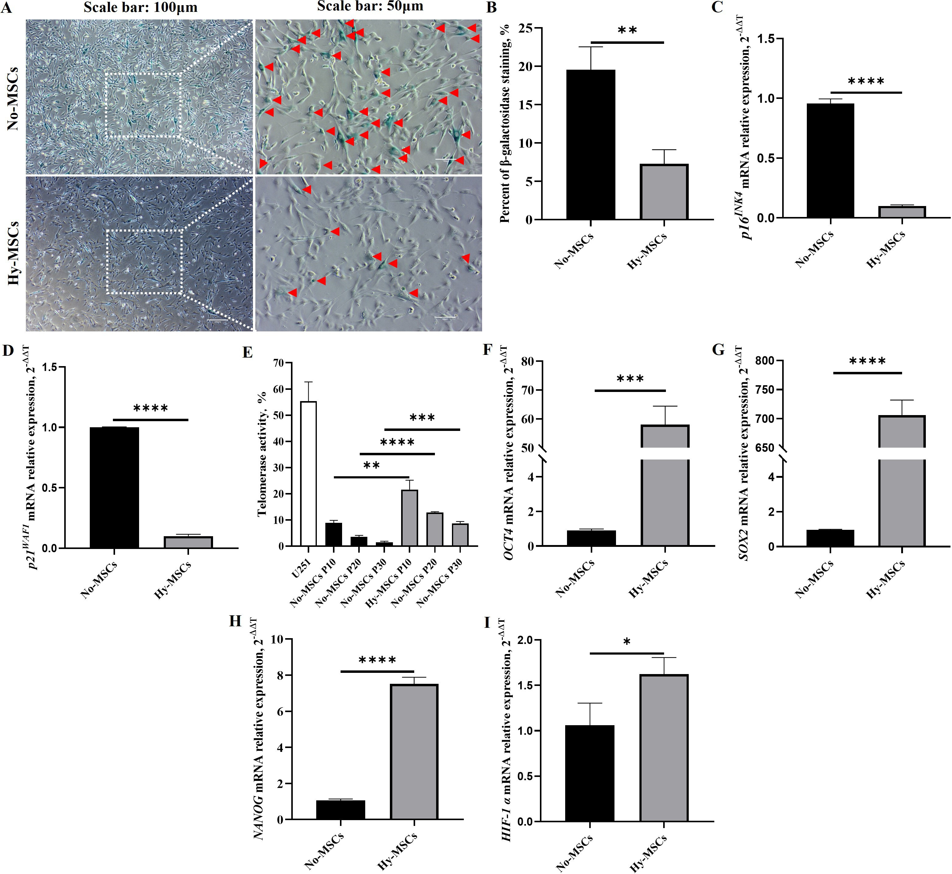 Fig. 5 
            The senescence level and stemness characteristics of human umbilical cord-derived mesenchymal stem cells (hUC-MSCs) in a long-term hypoxic atmosphere. a) The senescence level of both hUC-MSCs cultured with normoxic atmosphere (No-MSCs) and hypoxic hUC-MSCs (Hy-MSCs) were stained by β-galactosidase staining (P10). Scale bars: 100 μm and 50 μm. b) The positive β-galactosidase staining cells were counted and compared between No-MSCs and Hy-MSCs. c) and d) The expression of senescence genes of MSCs was detected by quantitative real-time polymerase chain reaction (qRT-PCR) assay, i.e. p16INK4a and p21WAF1. e) Telomerase activity of hUC-MSCs (P10, P20, and P30) was analyzed at normoxic and hypoxic atmospheres by PCR-ELISA assay. f) to h) The expression of stemness genes of hUC-MSCs was detected by qRT-PCR assay, i.e. OCT-4, SOX2, and NANOG. i) The expression of HIF-1α was tested in both No-MSCs and Hy-MSCs. Data are presented as mean (SD). *p < 0.05, **p < 0.01, ***p < 0.001, ****p < 0.0001, one-way analysis of variance (ANOVA). ELISA, enzyme-linked immunosorbent assay; PCR, polymerase chain reaction.
          