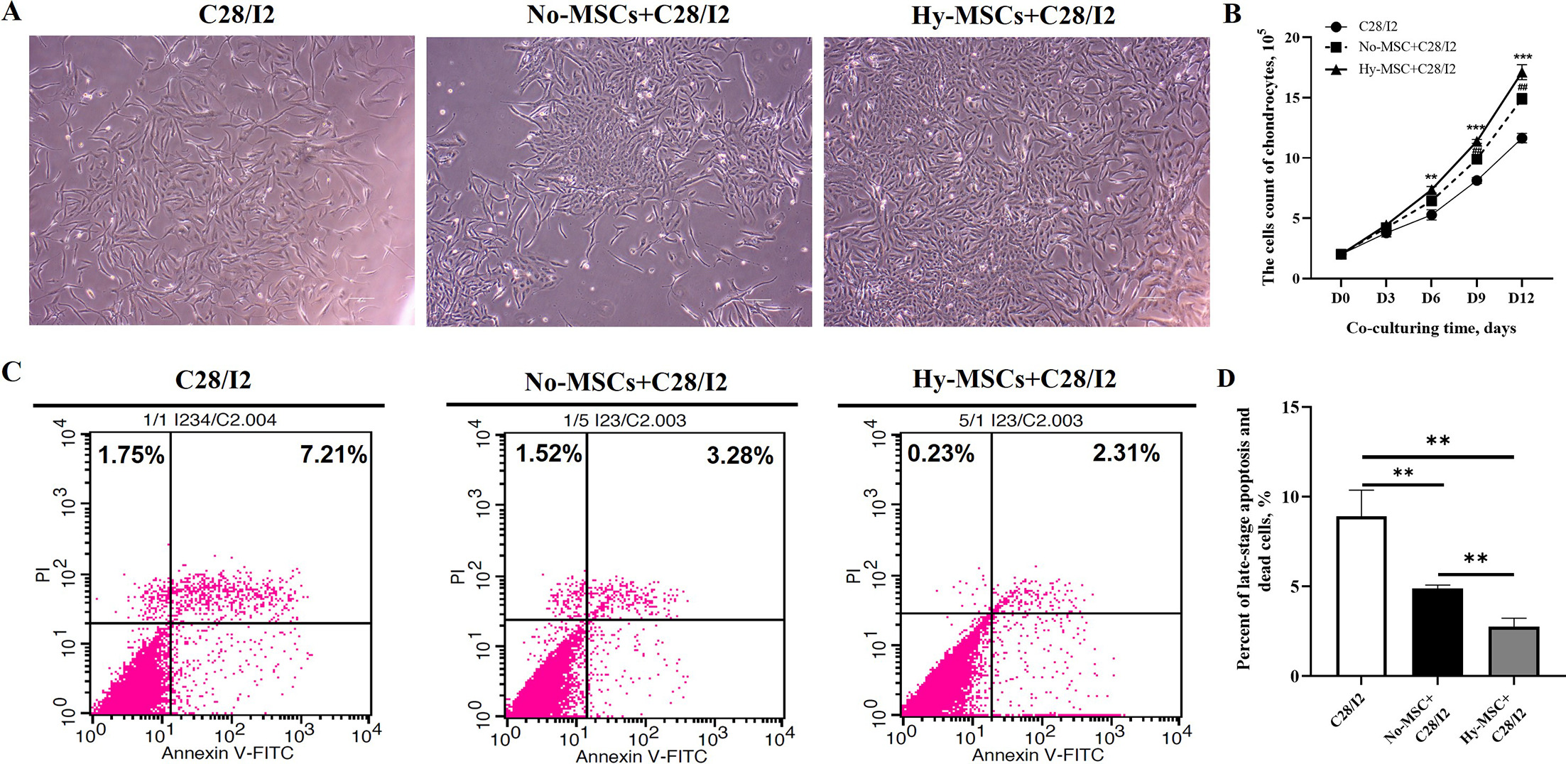 Fig. 7 
            Human umbilical cord-derived mesenchymal stem cells (hUC-MSCs) better inhibited apoptosis of chondrocytes in a hypoxic atmosphere. a) The growth state of chondrocytes after co-culturing with hUC-MSCs cultured with normoxic atmosphere (No-MSCs) and hypoxic hUC-MSCs (Hy-MSCs) for three days. b) The statistical analysis of the chondrocytes count after co-culturing with No-MSCs and Hy-MSCs by comparing with control C28/I2. c) Flow cytometry detection of apoptosis levels on chondrocytes after co-culturing with No-MSCs and Hy-MSCs for three days. d) The comparative analysis of late-stage and death apoptosis levels on chondrocytes after co-culturing with No-MSCs and Hy-MSCs. Data are presented as mean (SD). *p < 0.05, **p < 0.01, ***p < 0.001, one-way analysis of variance (ANOVA).
          