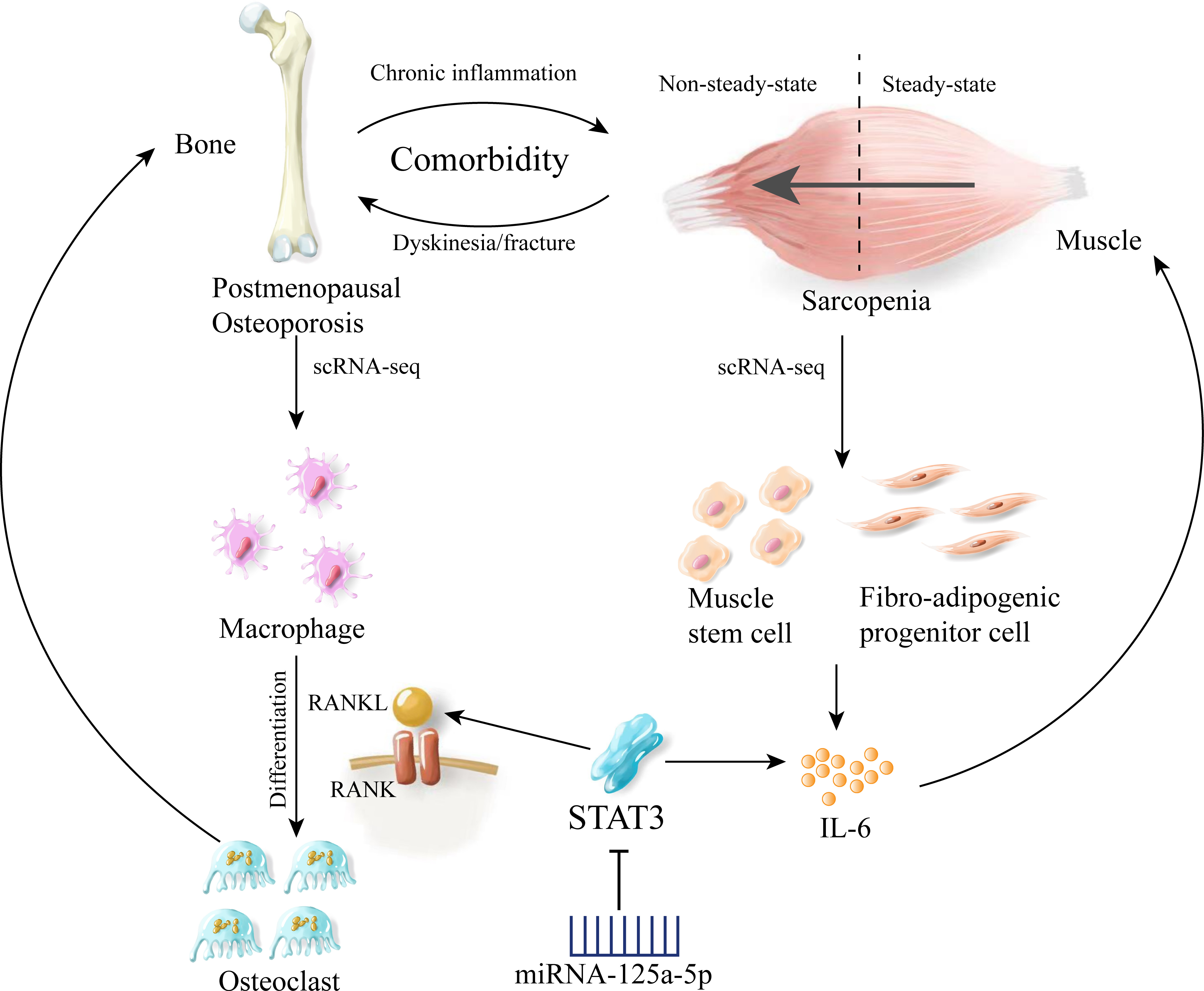 Fig. 9 
          Proposed molecular mechanisms linking postmenopausal osteoporosis (POMP) and sarcopenia. Chronic inflammation and comorbidity lead to a bidirectional interaction between bone and muscle, known as the bone-muscle axis. In POMP, single-cell RNA sequencing (scRNA-seq) analysis reveals high signal transducer and activator of transcription 3 (STAT3) expression in macrophages, which activates the RANKL/RANK pathway and promotes osteoclast differentiation, leading to increased bone resorption and dyskinesia/fracture. In sarcopenia, scRNA-seq analysis shows elevated STAT3 expression in muscle stem cells and fibro-adipogenic progenitors (FAPs). Abnormally activated FAPs overexpress STAT3 and secrete interleukin (IL)-6, resulting in muscle atrophy and fibrosis. The competing endogenous RNA (ceRNA) network analysis identifies microRNA (miRNA)-125a-5p as a potential regulator of STAT3, suggesting its role in modulating the pathogenesis of both diseases. The comorbidity and interaction between POMP and sarcopenia exacerbate each other, leading to a non-steady-state condition. Targeting the shared molecular pathways, such as the STAT3/miRNA-125a-5p axis, may provide a novel therapeutic strategy for managing these age-related musculoskeletal disorders.
        