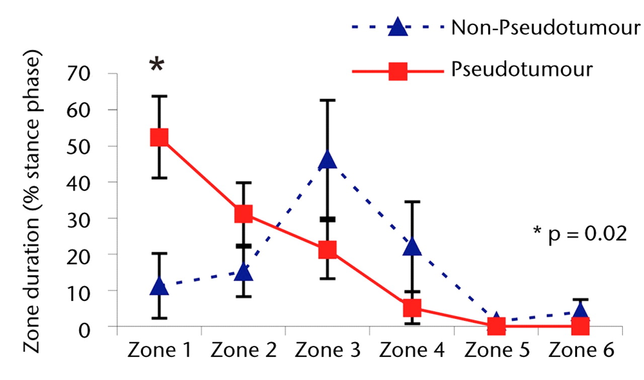 Figs. 3a - 3c 
            Graphs showing the distribution
of ‘zone duration’ (the percentage of total stance time spent by
the force path in each zone) during a) walking, b) stair climbing
and c) rising from a chair. Zone 1 is defined as the edge-loading
zone. The error bars represent standard errors of mean. An asterisk
(*) indicates significant difference between the two MoMHRA patient
groups.
          