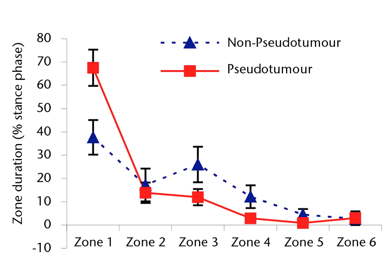 Figs. 3a - 3c 
            Graphs showing the distribution
of ‘zone duration’ (the percentage of total stance time spent by
the force path in each zone) during a) walking, b) stair climbing
and c) rising from a chair. Zone 1 is defined as the edge-loading
zone. The error bars represent standard errors of mean. An asterisk
(*) indicates significant difference between the two MoMHRA patient
groups.
          