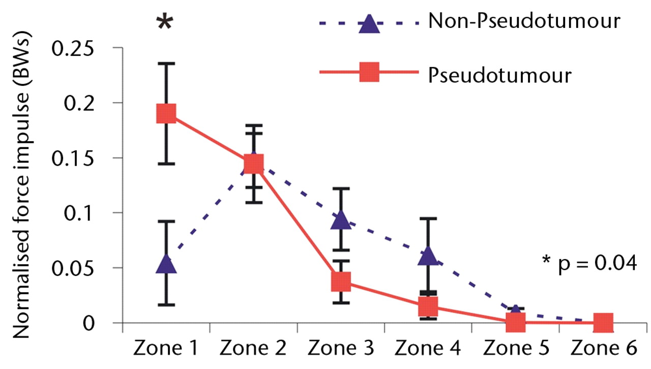 Figs. 4a - 4c 
            Graphs showing the distribution
of normalised hip joint ‘force impulse’ (the cumulative magnitude
of the segment force throughout activity over time estimated by
calculating the area under the force/time curve normalised to patient body
weight) in each zone during a) walking, b) stair climbing and c) rising
from a chair. Zone 1 is defined as the edge-loading zone. The error
bars represent standard errors of mean. An asterisk (*) indicates
significant difference between the two MoMHRA patient groups.
          