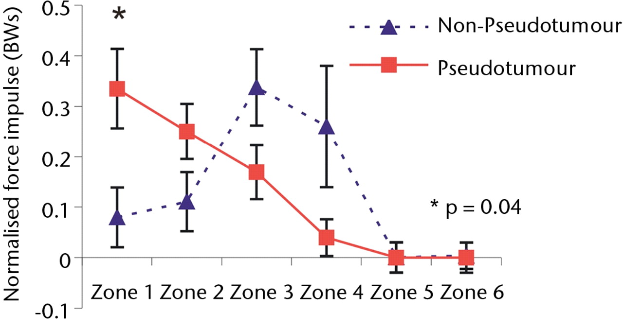 Figs. 4a - 4c 
            Graphs showing the distribution
of normalised hip joint ‘force impulse’ (the cumulative magnitude
of the segment force throughout activity over time estimated by
calculating the area under the force/time curve normalised to patient body
weight) in each zone during a) walking, b) stair climbing and c) rising
from a chair. Zone 1 is defined as the edge-loading zone. The error
bars represent standard errors of mean. An asterisk (*) indicates
significant difference between the two MoMHRA patient groups.
          