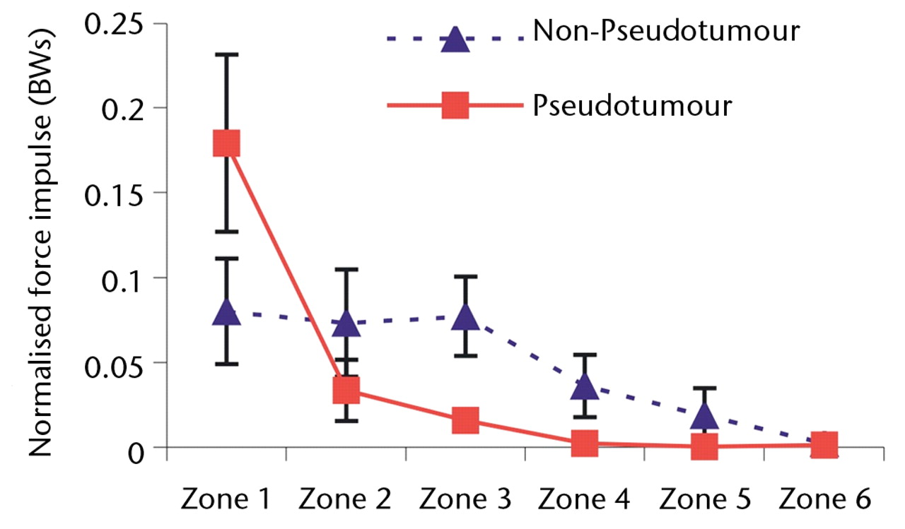 Figs. 4a - 4c 
            Graphs showing the distribution
of normalised hip joint ‘force impulse’ (the cumulative magnitude
of the segment force throughout activity over time estimated by
calculating the area under the force/time curve normalised to patient body
weight) in each zone during a) walking, b) stair climbing and c) rising
from a chair. Zone 1 is defined as the edge-loading zone. The error
bars represent standard errors of mean. An asterisk (*) indicates
significant difference between the two MoMHRA patient groups.
          